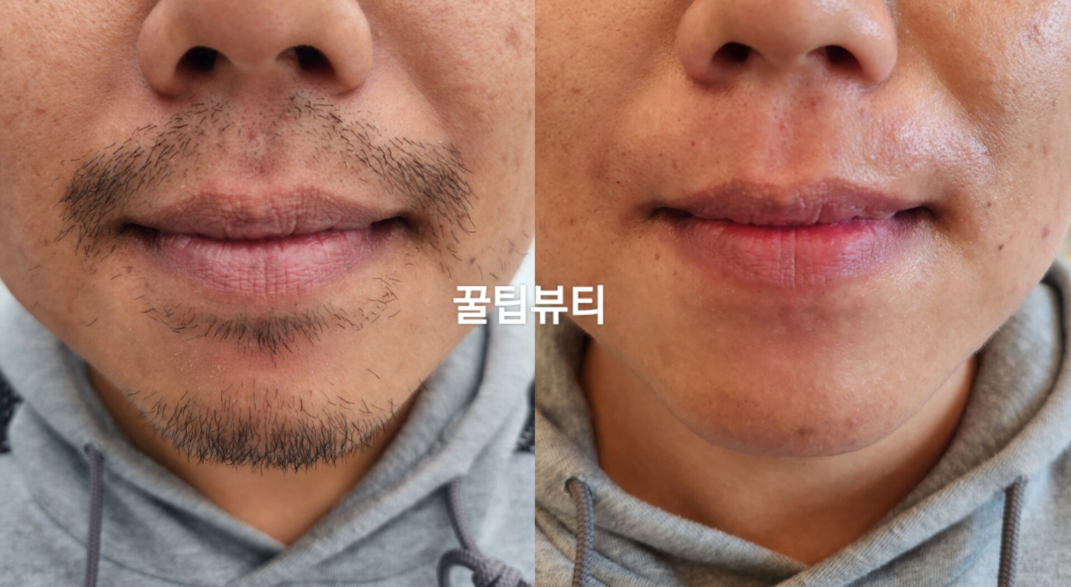 꿀팁뷰티 photo 8