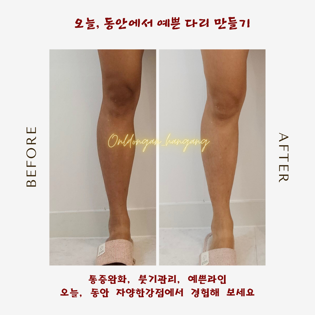 오늘,동안 자양한강점 photo 10
