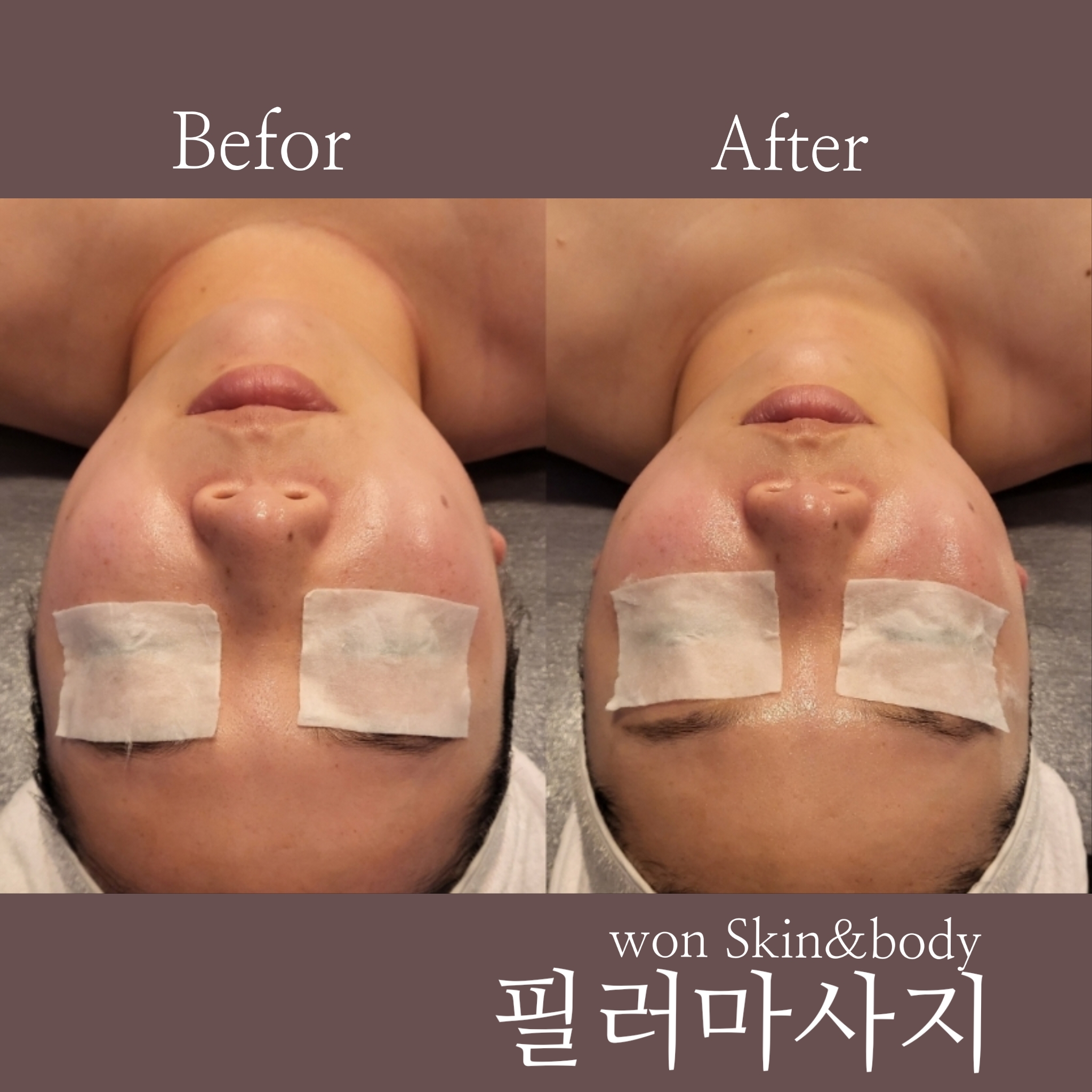 원스킨바디