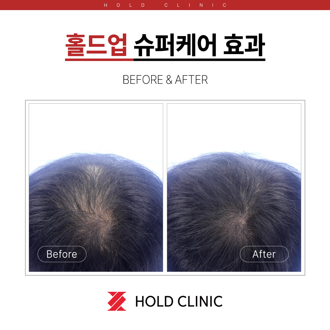 홀드의원 대표 이미지