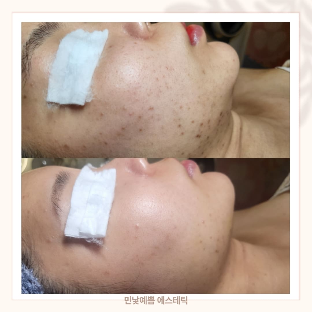 민낯예쁨 에스테틱