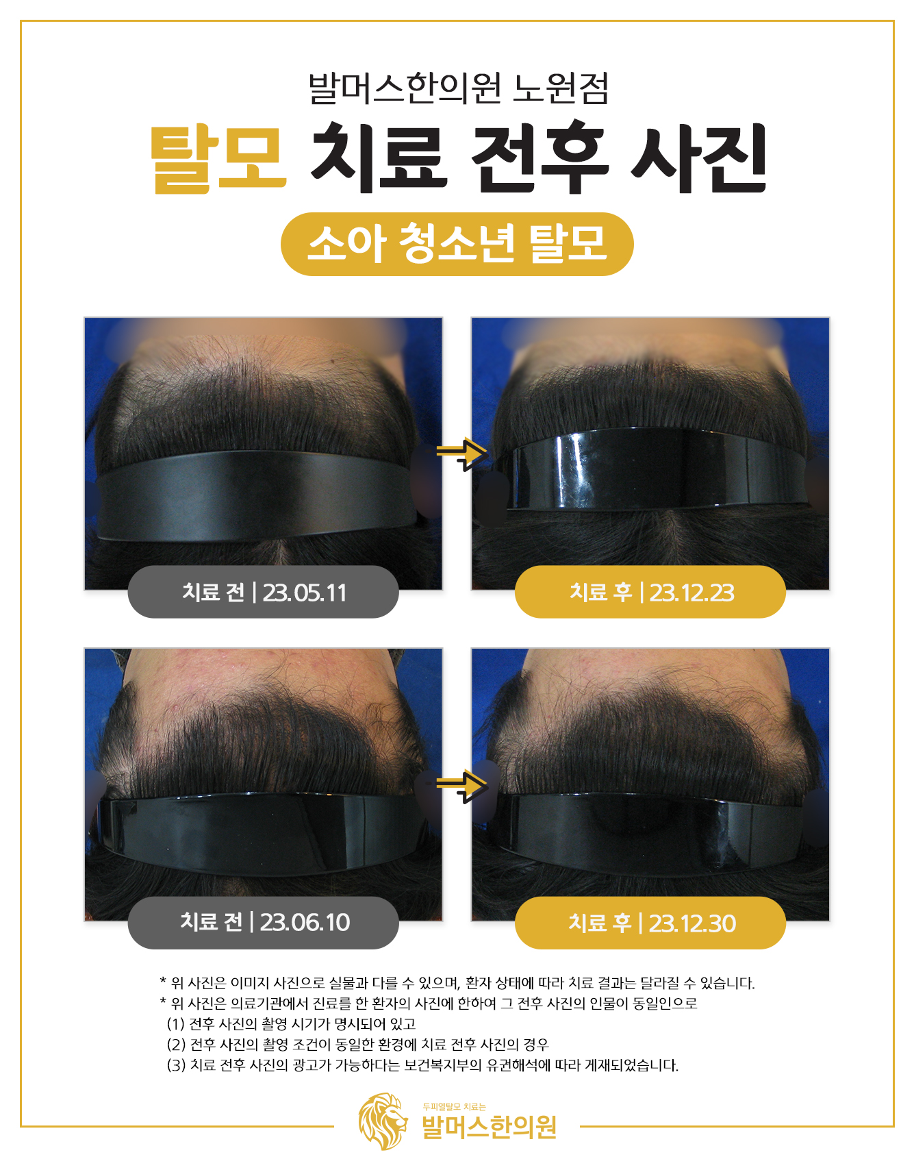 발머스한의원 노원 대표 이미지