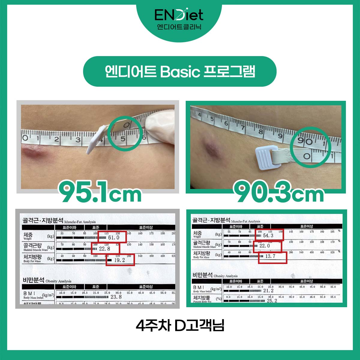 엔디어트의원 대표 이미지