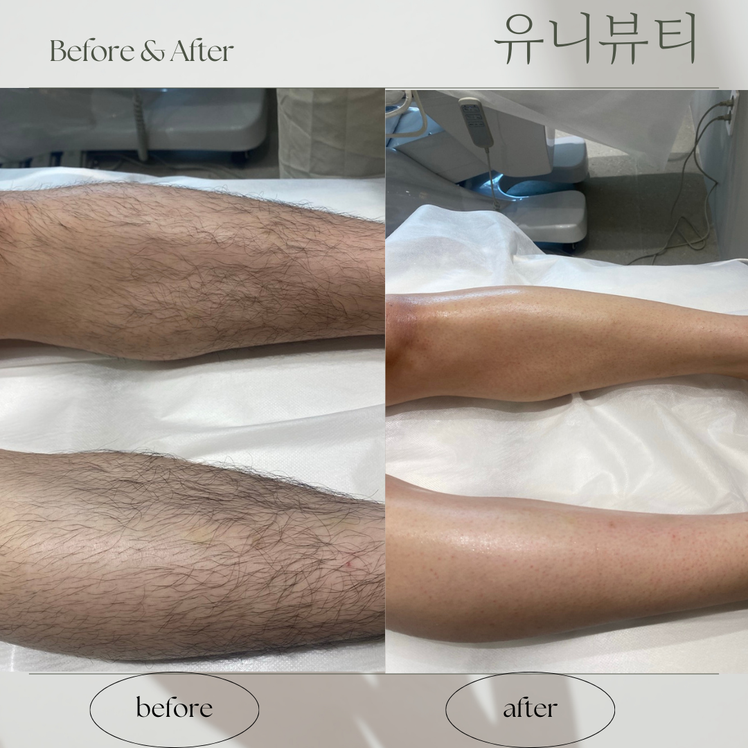 유니뷰티