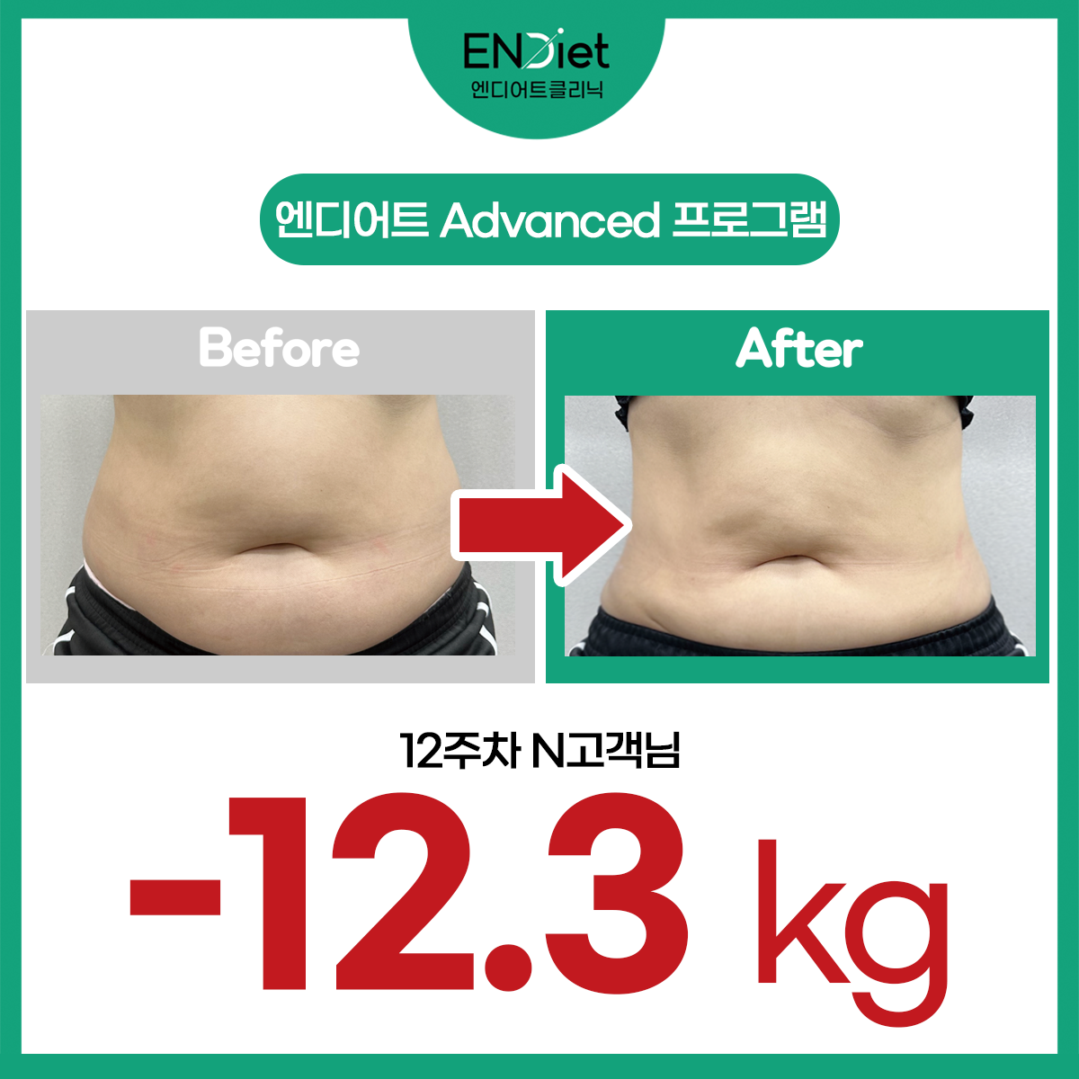 엔디어트의원 대표 이미지