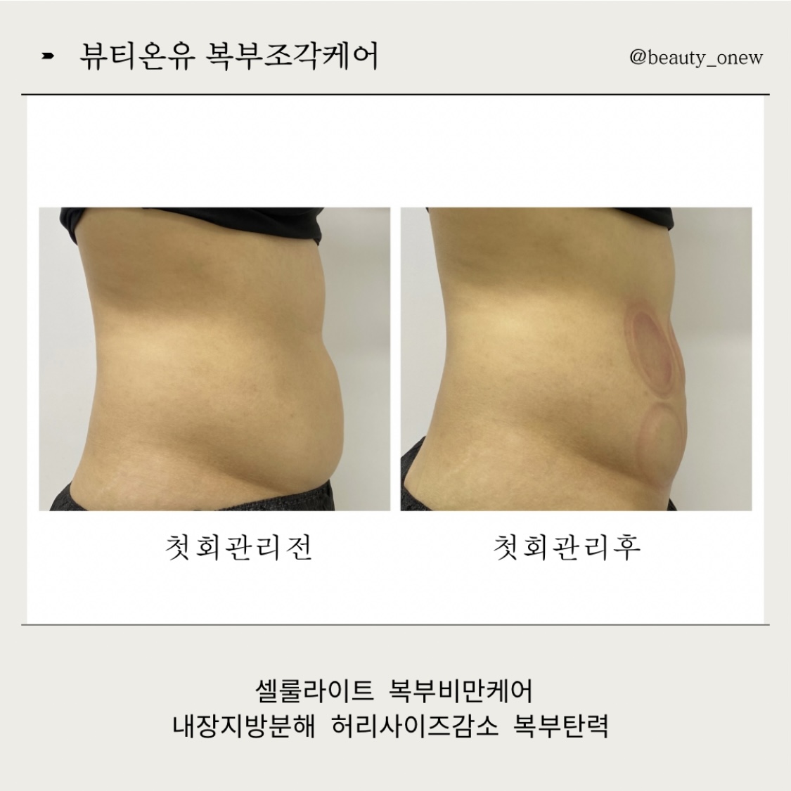 뷰티온유왁싱&눈썹&스킨케어미사역본점