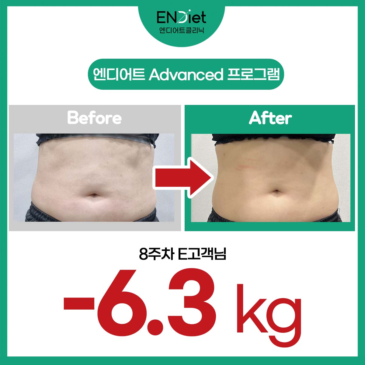 엔디어트의원 대표 이미지