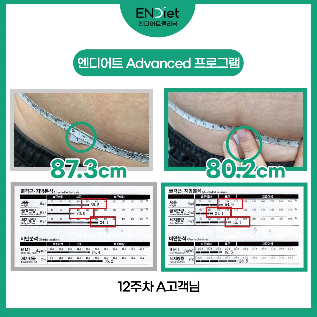 엔디어트의원 대표 이미지