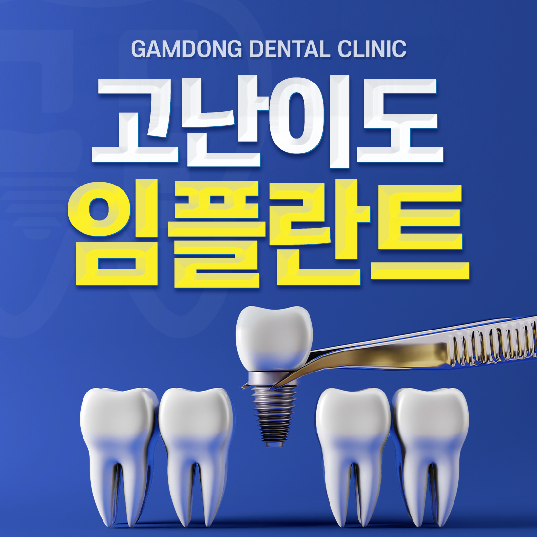 감동플란트치과의원 구월동점 대표 이미지