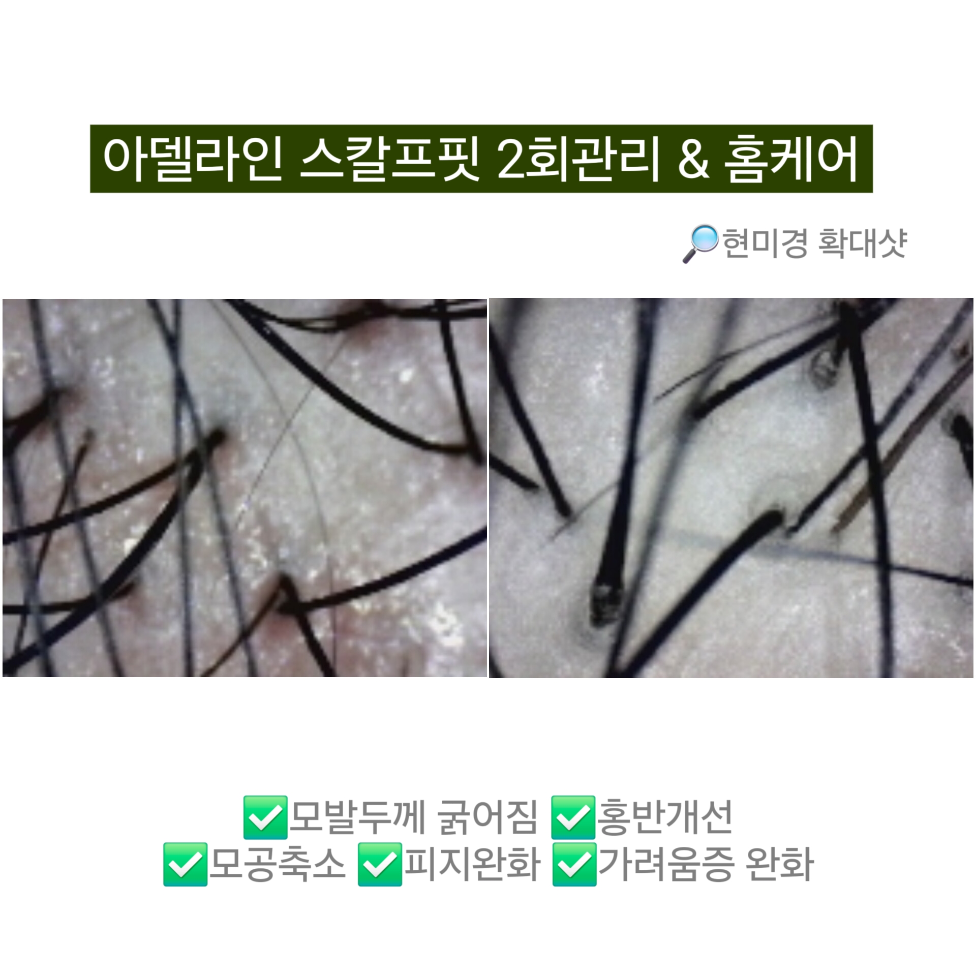 아델라인 뷰티&바디테라피