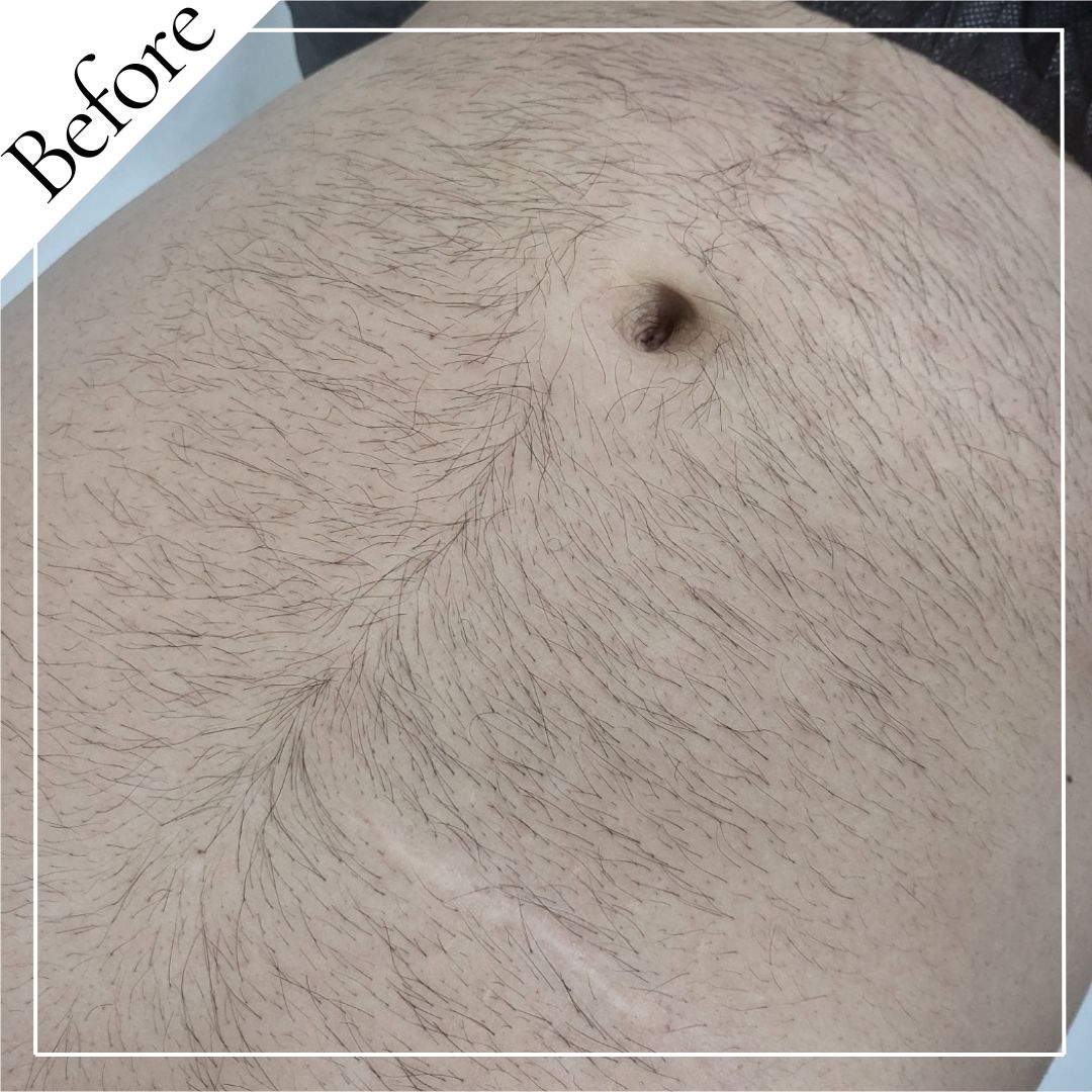 블랑뷰티랩