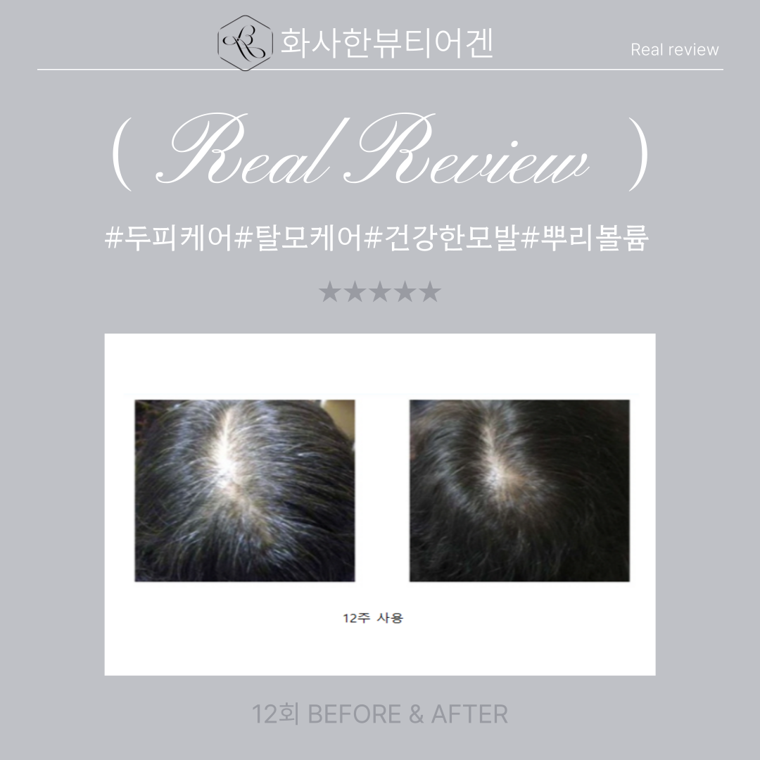 화사한뷰티어겐 대표 이미지
