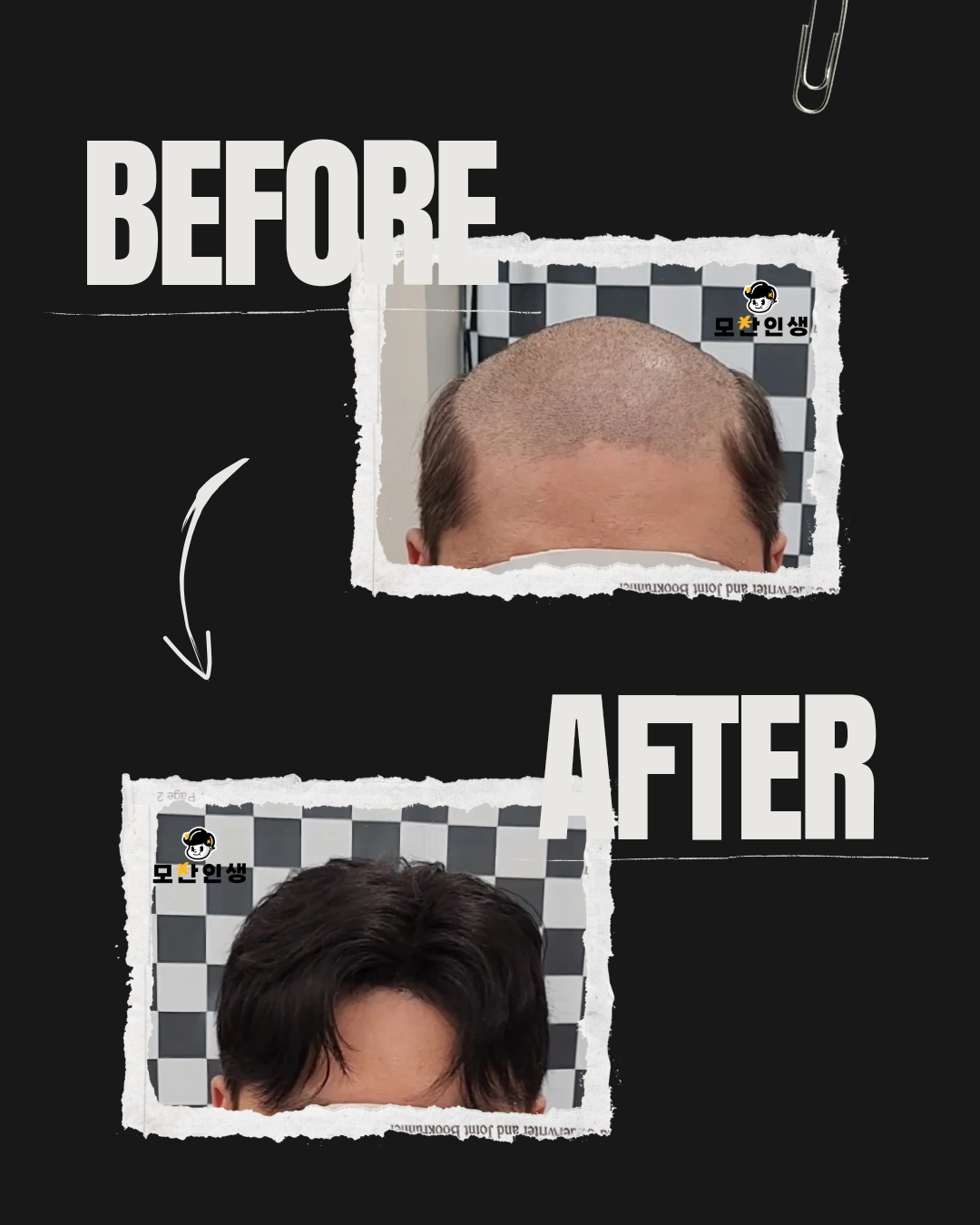 모찬인생