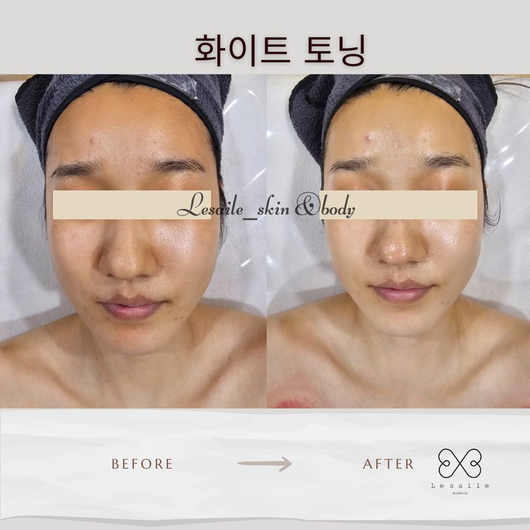 레젤스킨앤바디