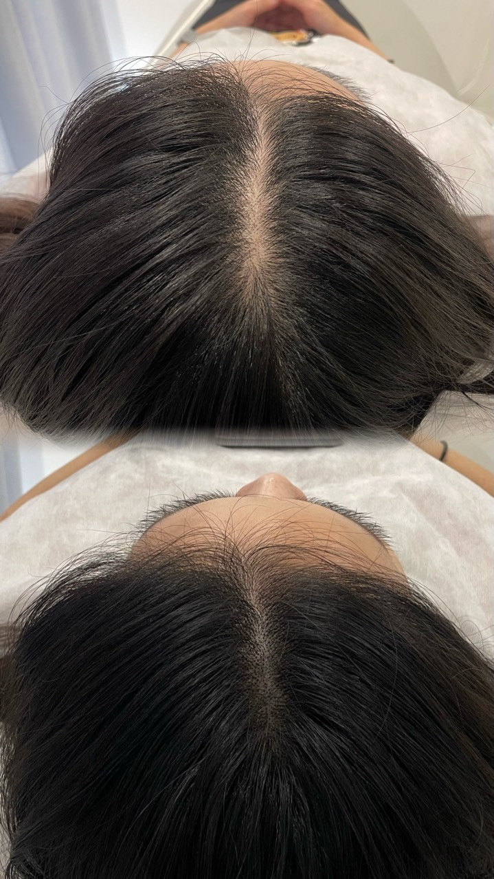 유오브미 왁싱&멜라닌케어 대표 이미지