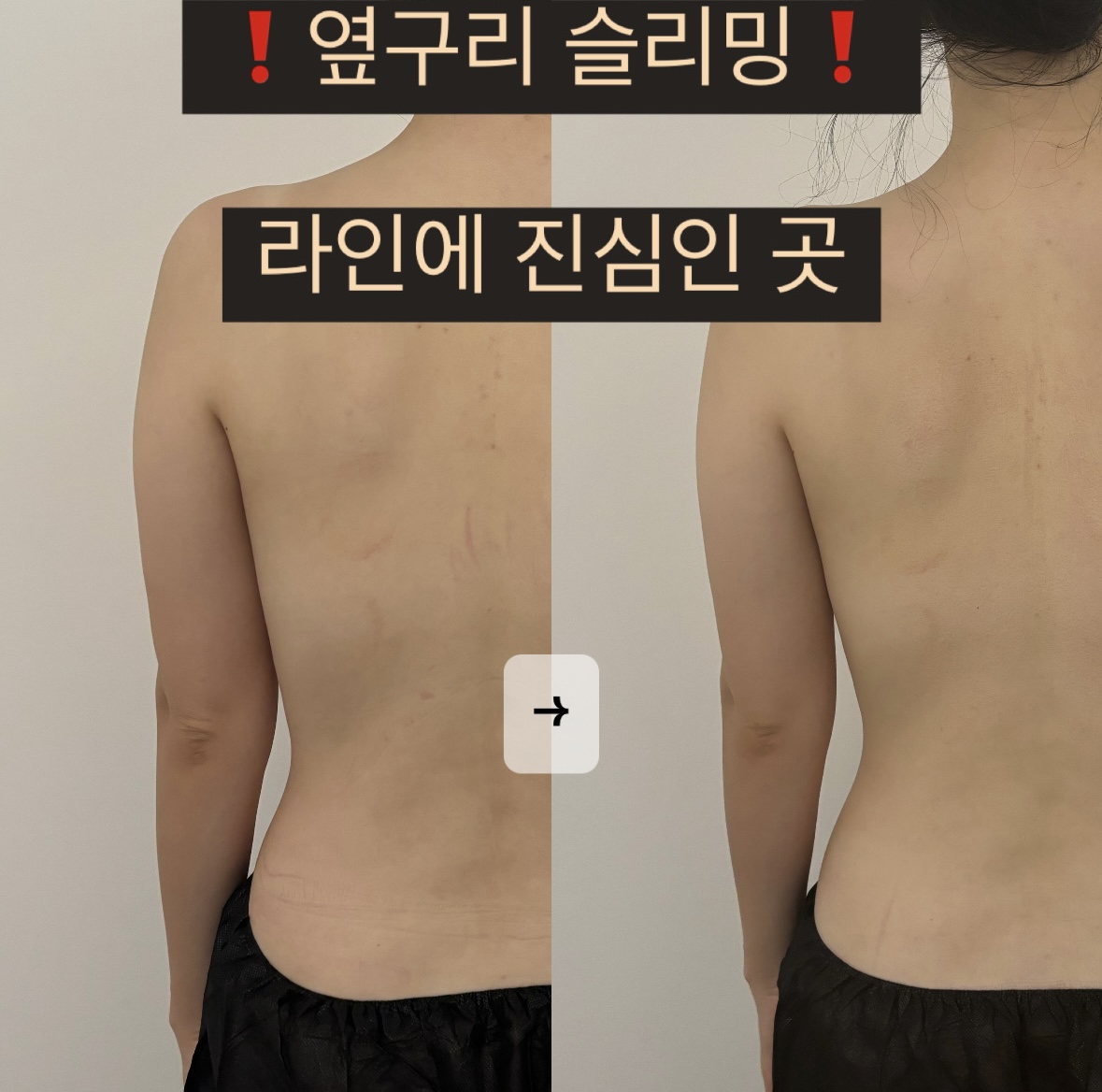 이프로움 photo 10