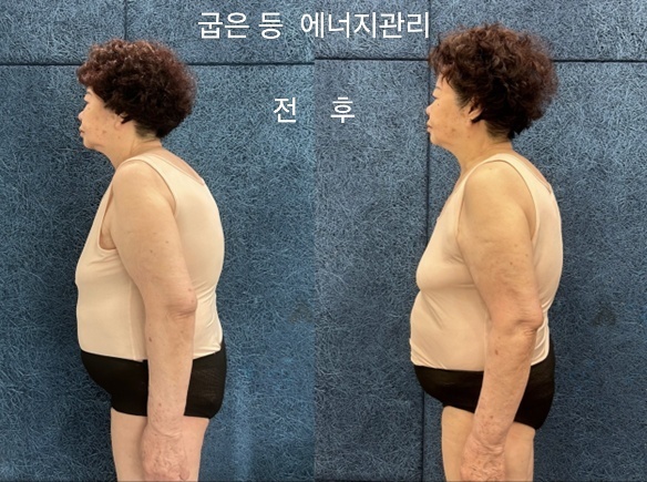수뷰티&귀족다이어트