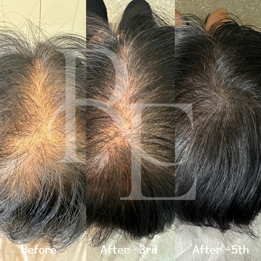 리디자인 대표 이미지