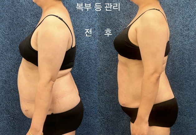 수뷰티&귀족다이어트