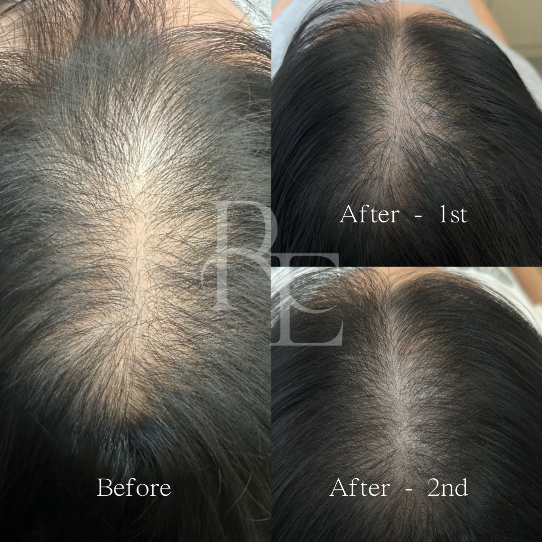 리디자인 대표 이미지