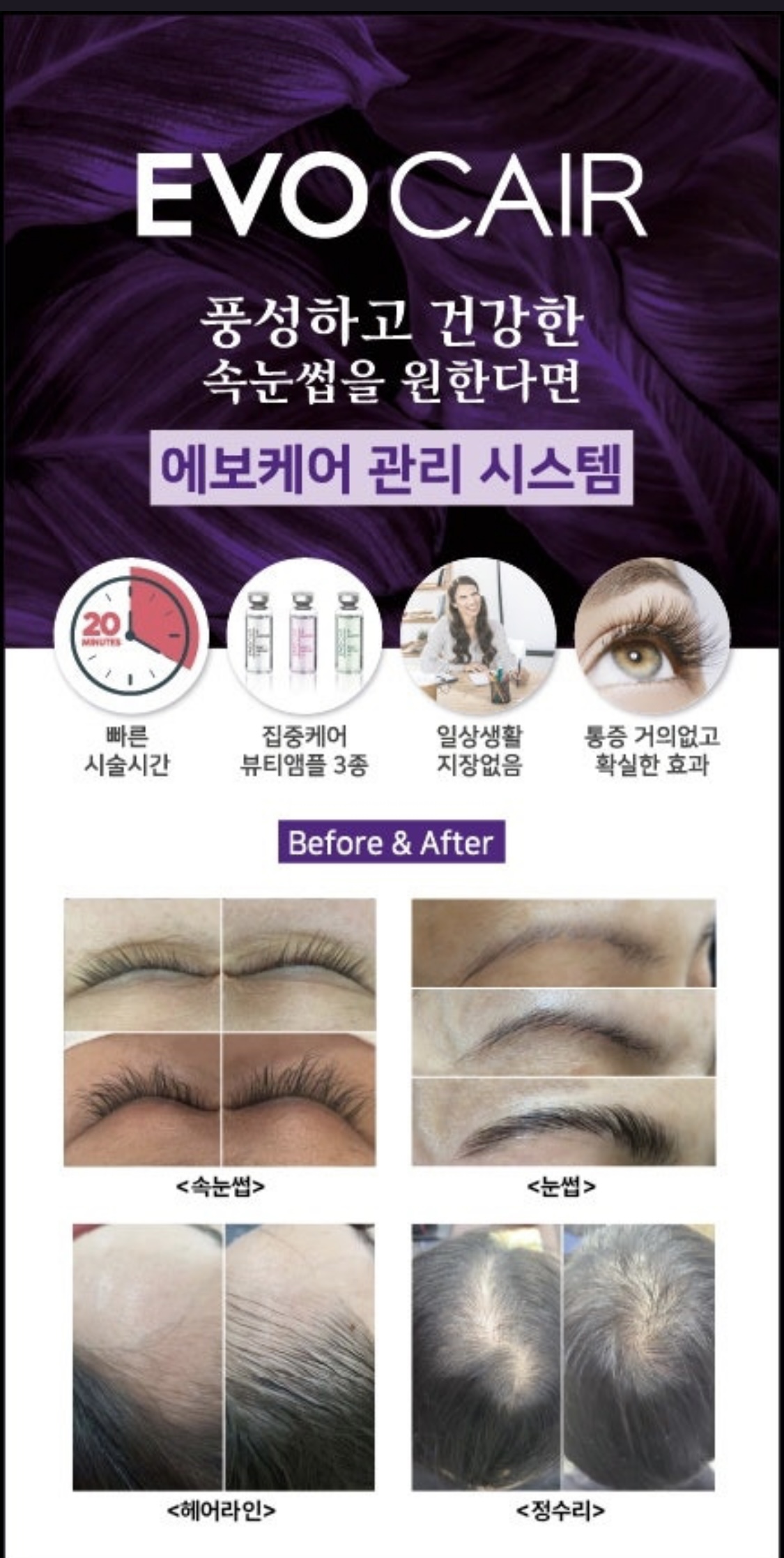 리디자인 대표 이미지