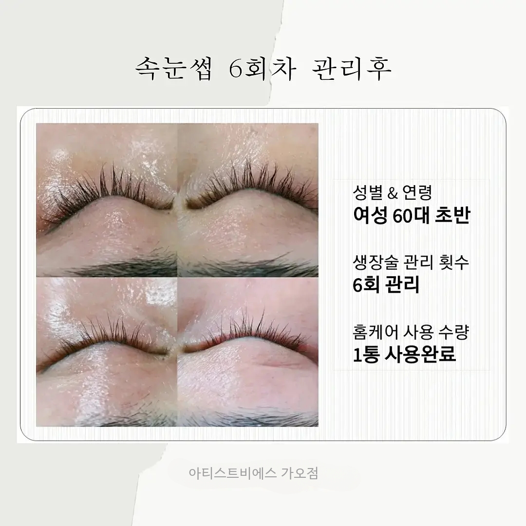 아티스트비에스가오점 대표 이미지