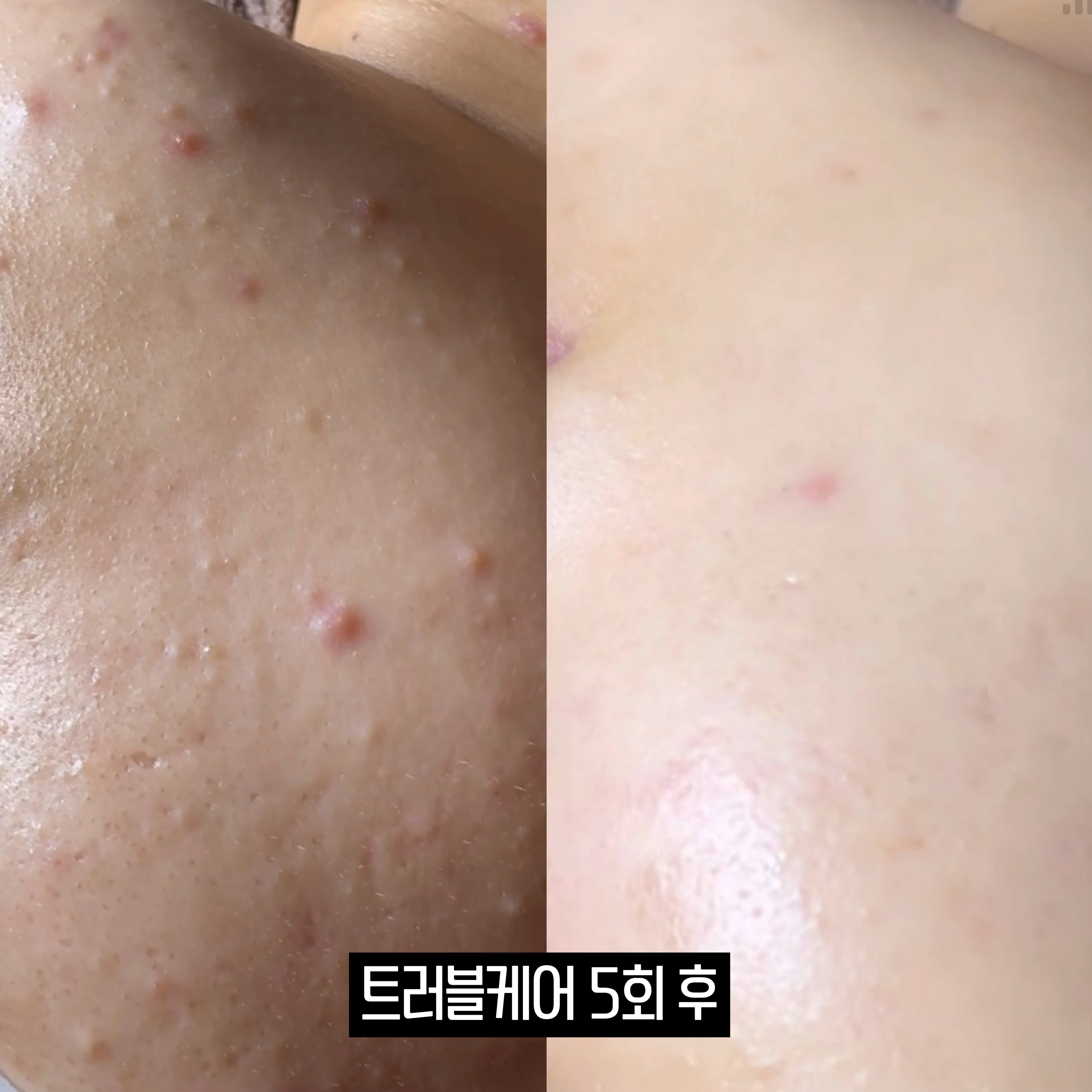 올스킨라운지 왕십리점