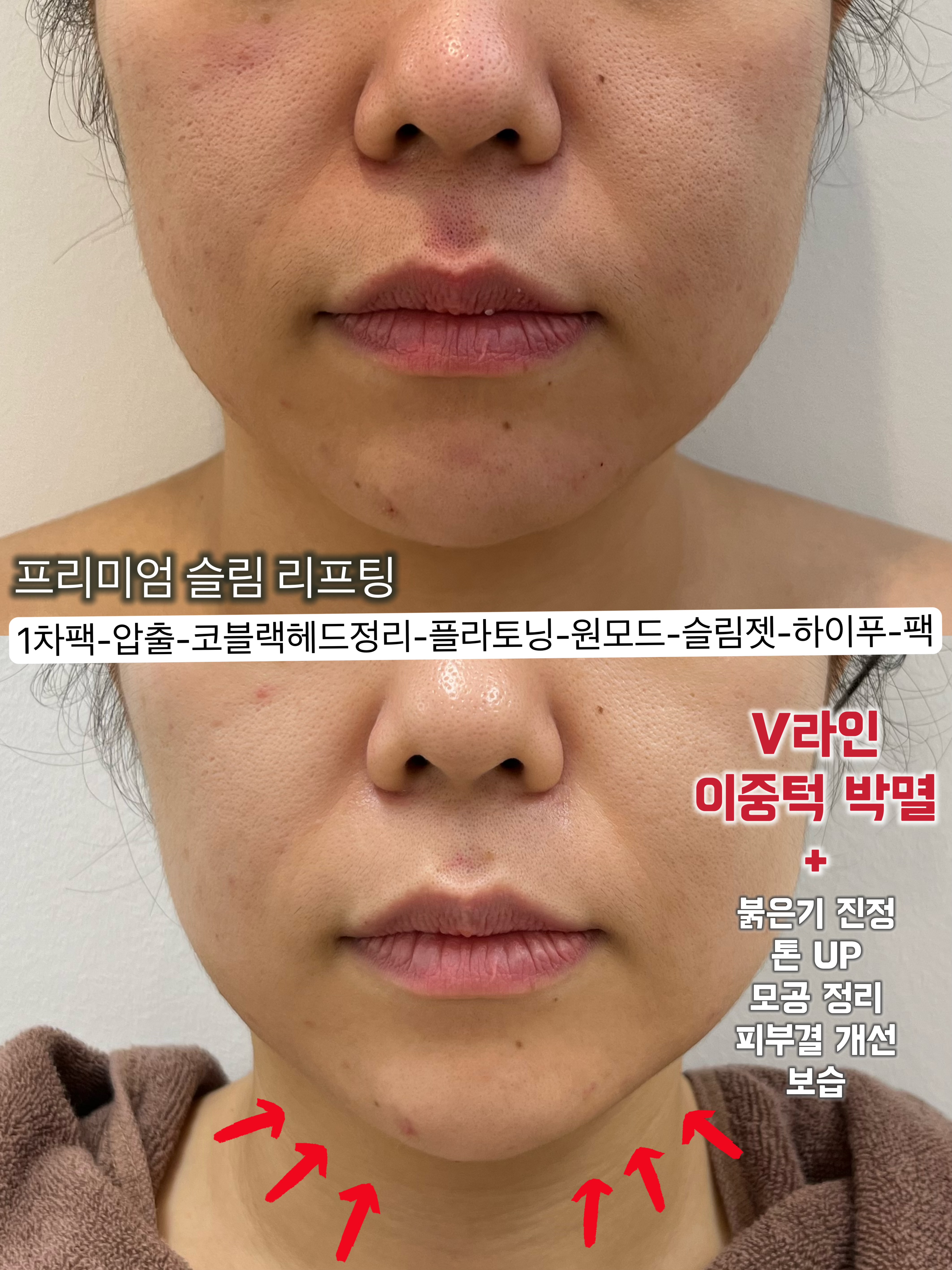 올스킨라운지 왕십리점