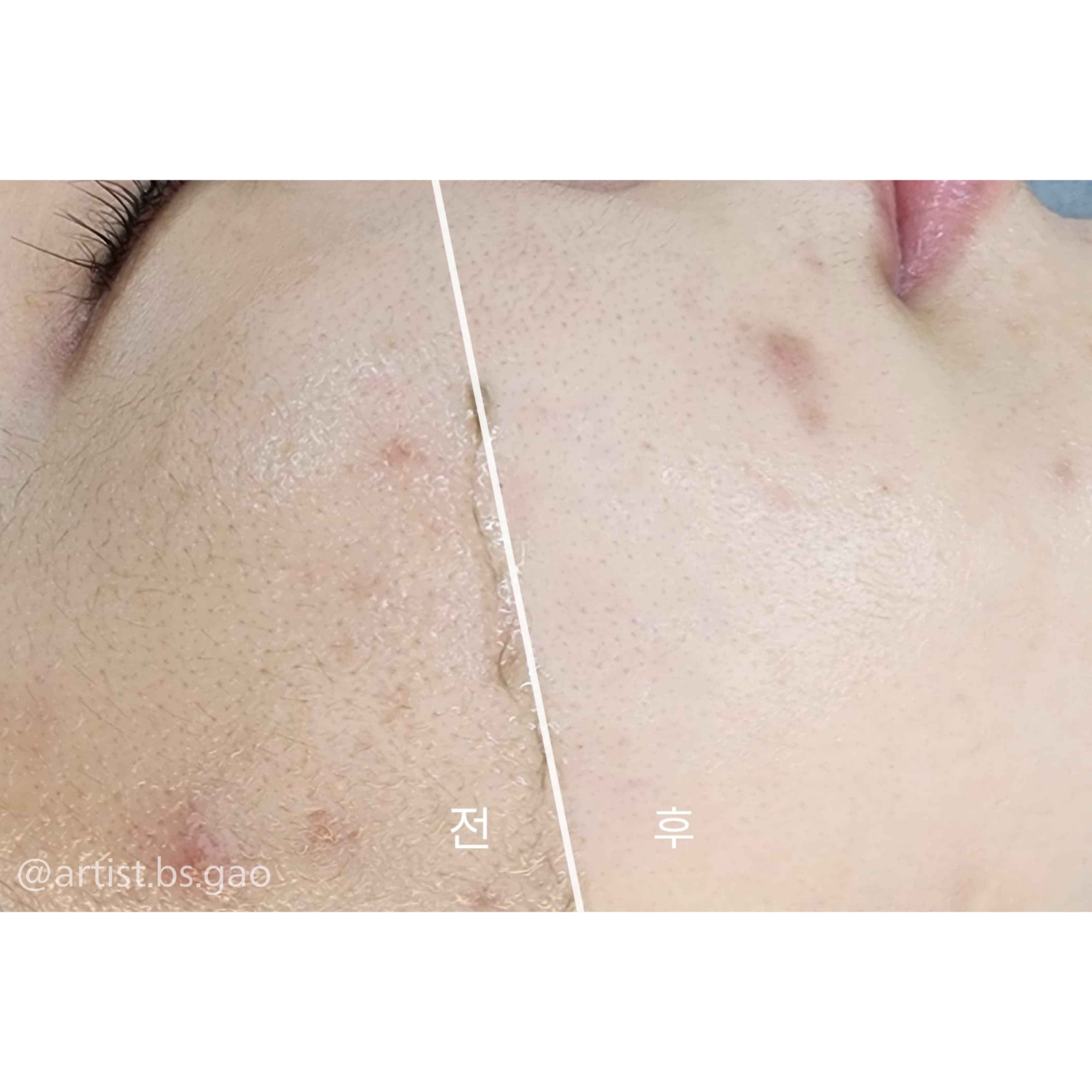 아티스트비에스가오점 대표 이미지