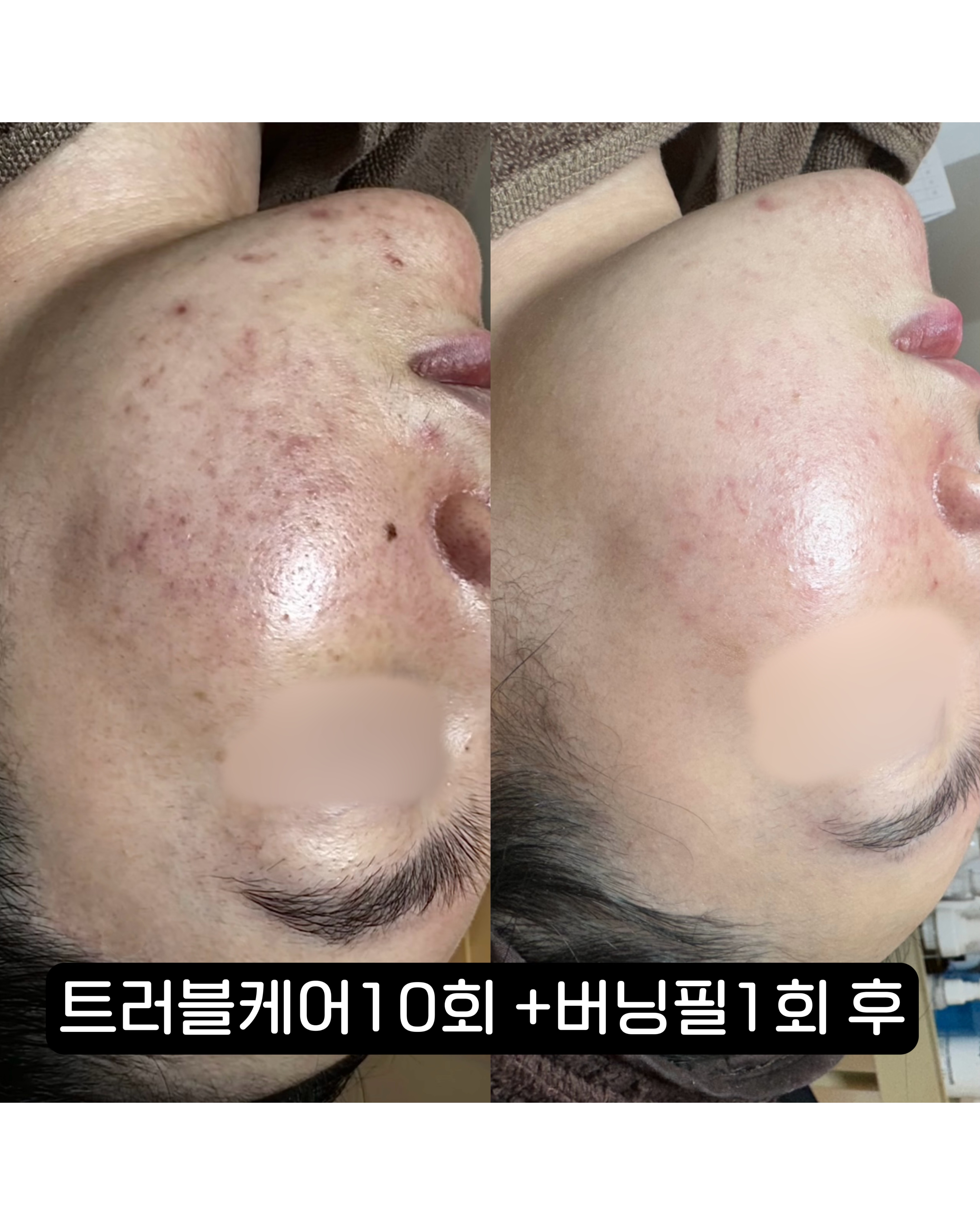 올스킨라운지 왕십리점