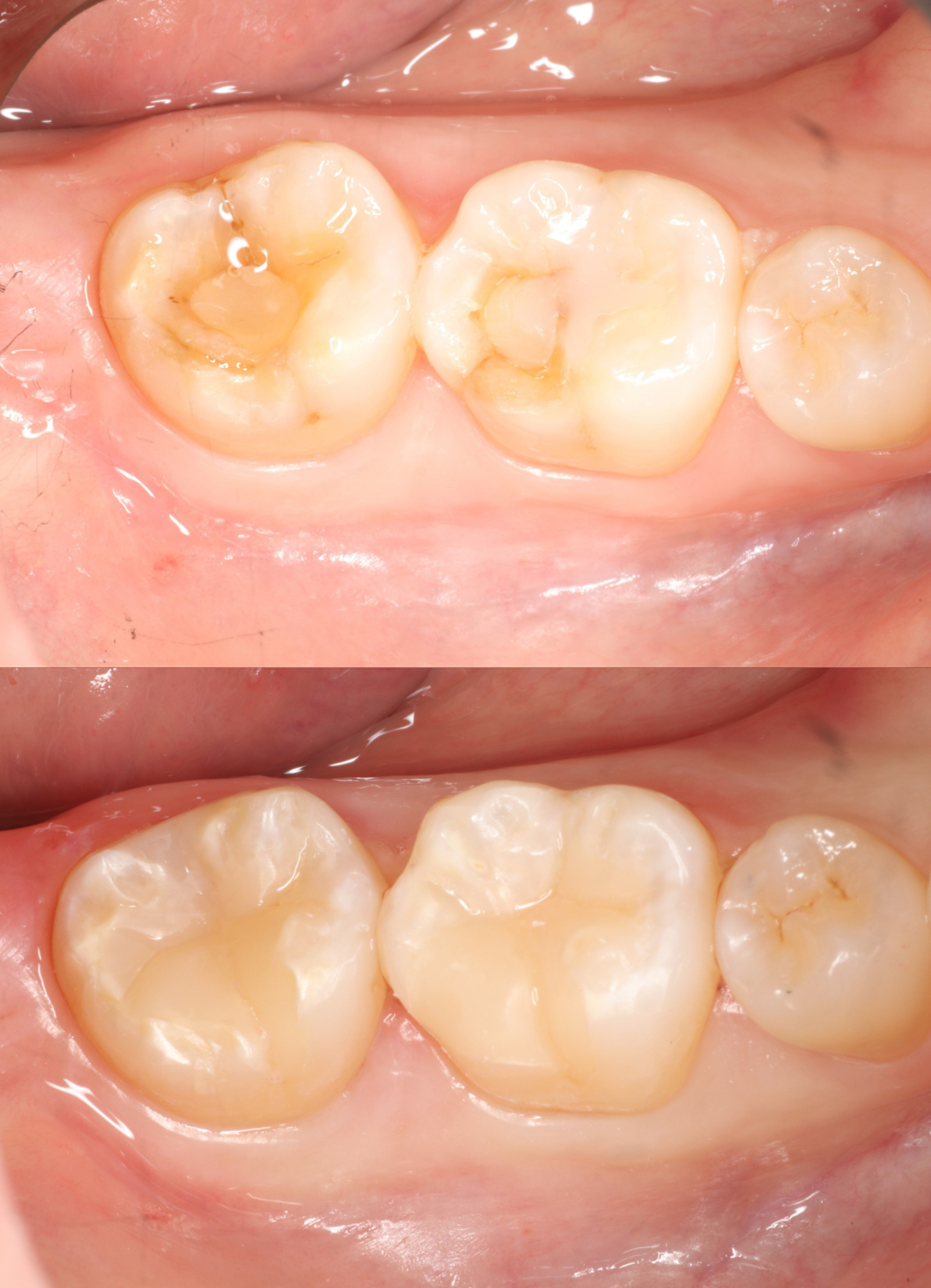 연세웰치과의원 대표 이미지