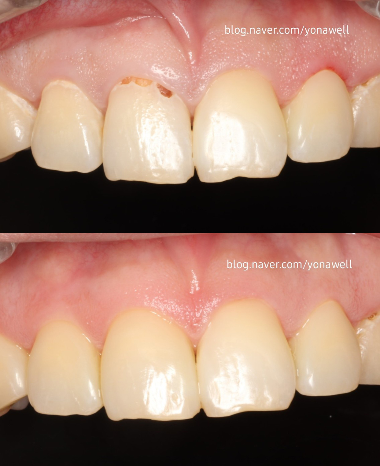 연세웰치과의원 대표 이미지