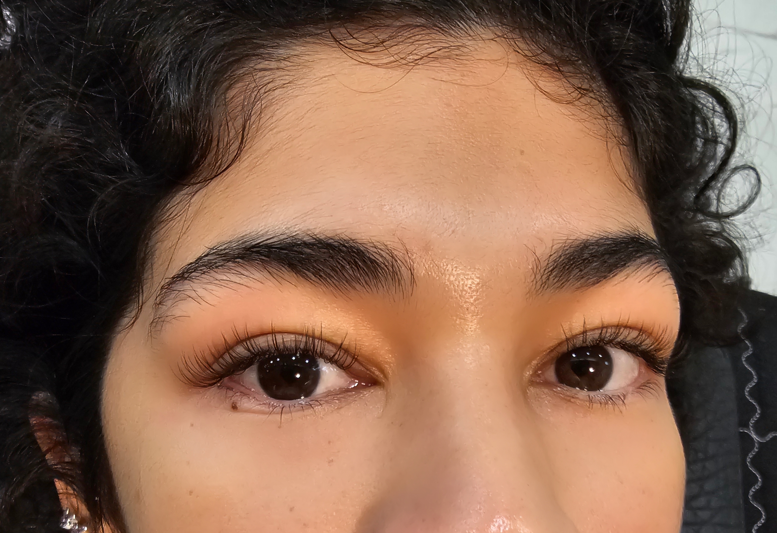 드니엘래쉬 대표 이미지