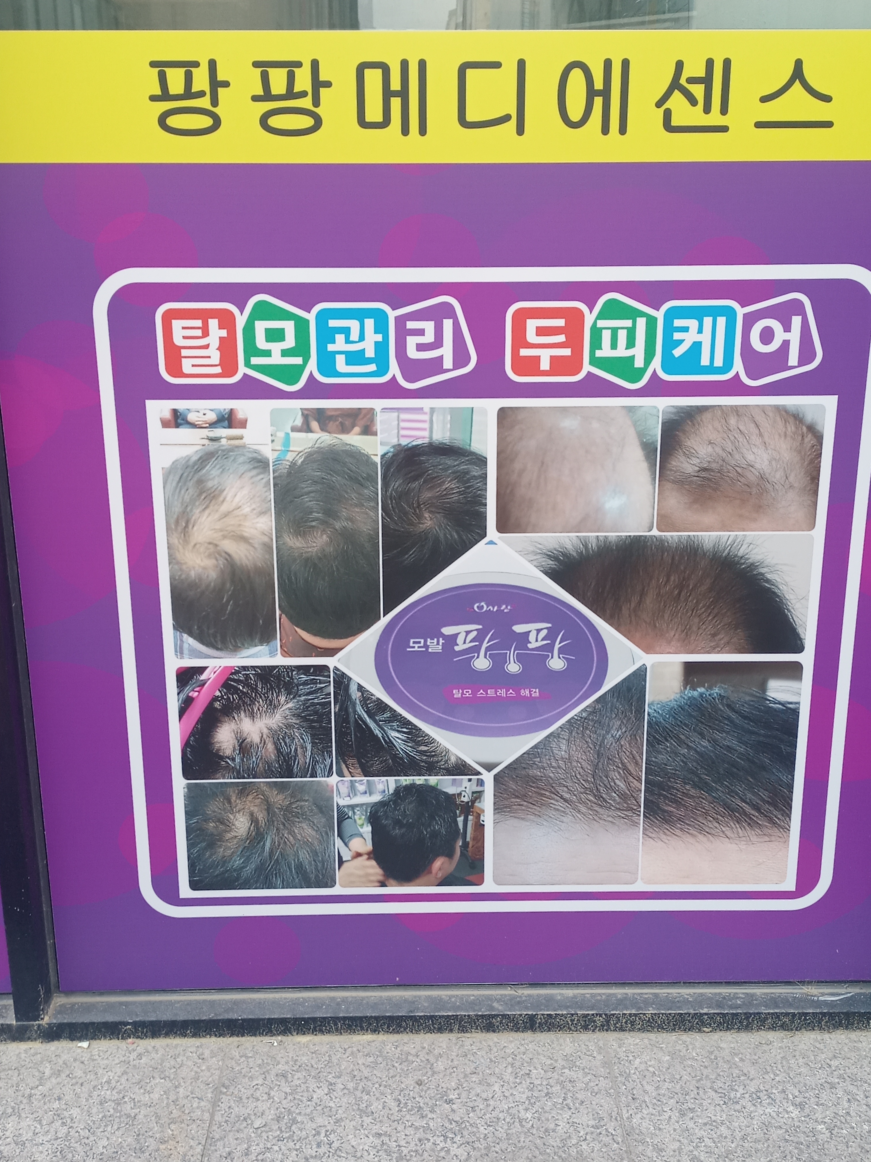 큐사랑염색두피탈모 비전점