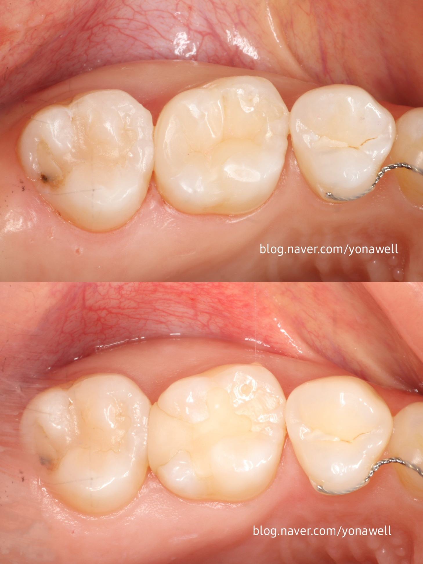 연세웰치과의원 대표 이미지