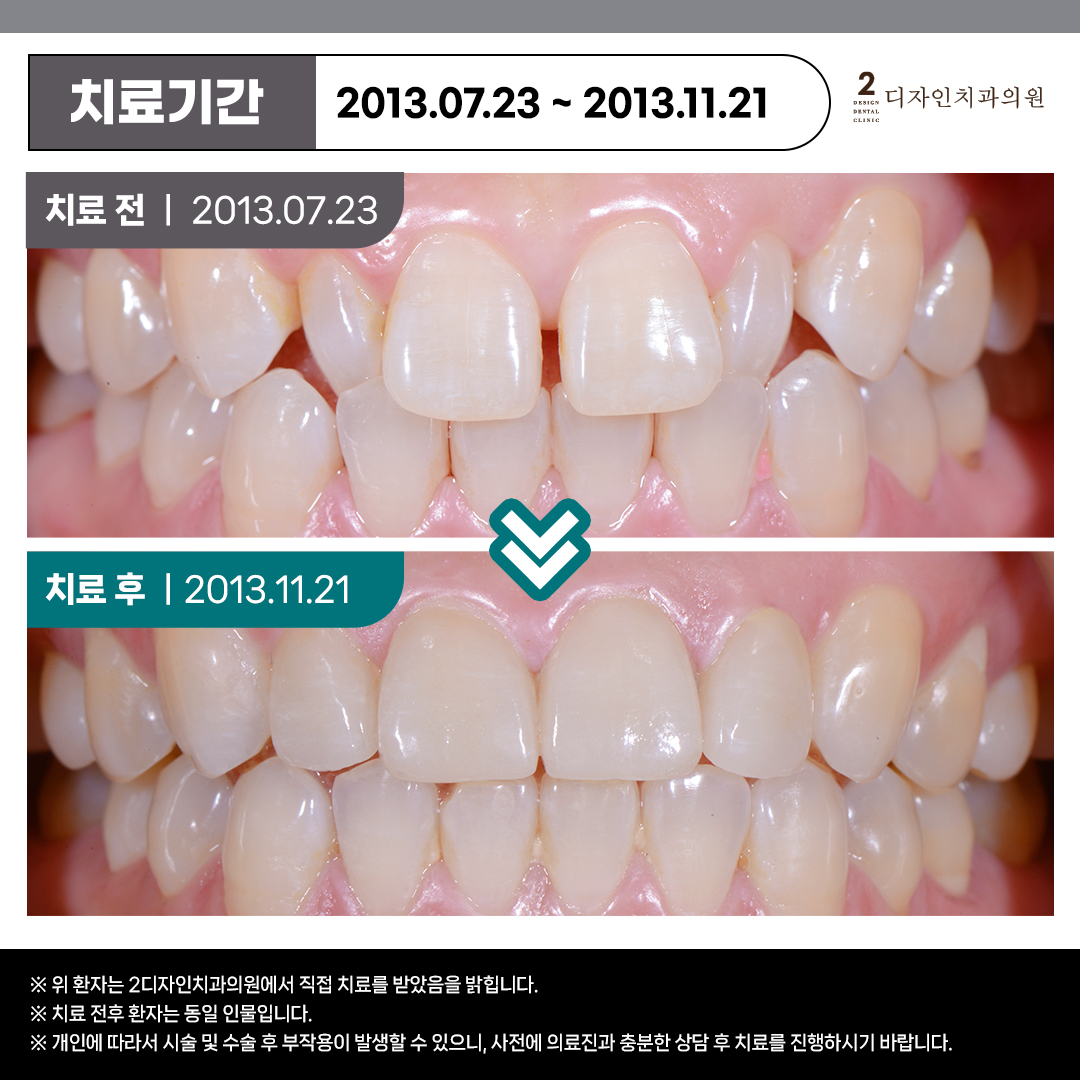 2디자인치과의원 대표 이미지