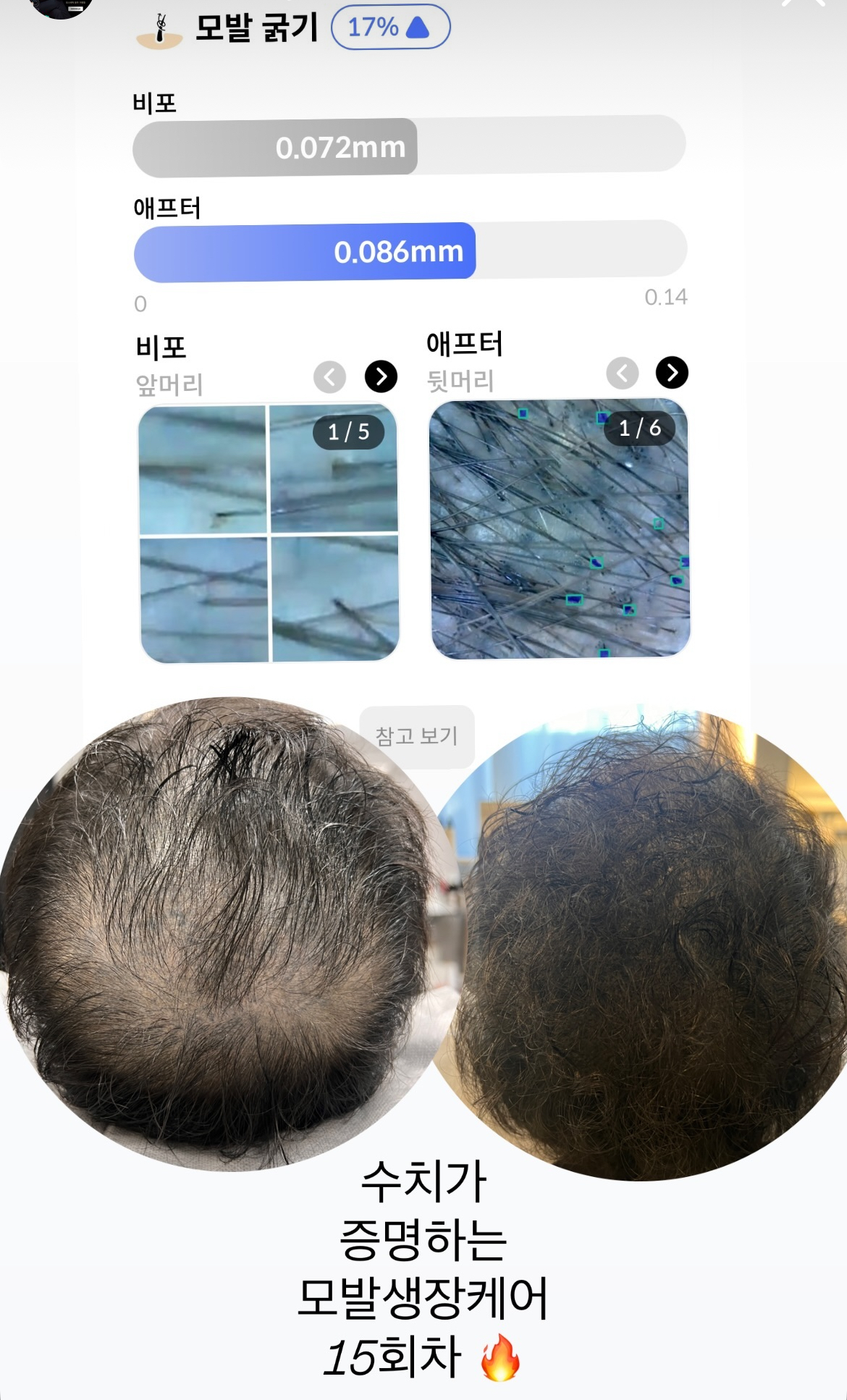 모스테틱 대표 이미지