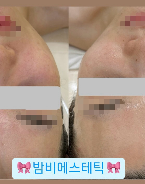 밤비에스테틱