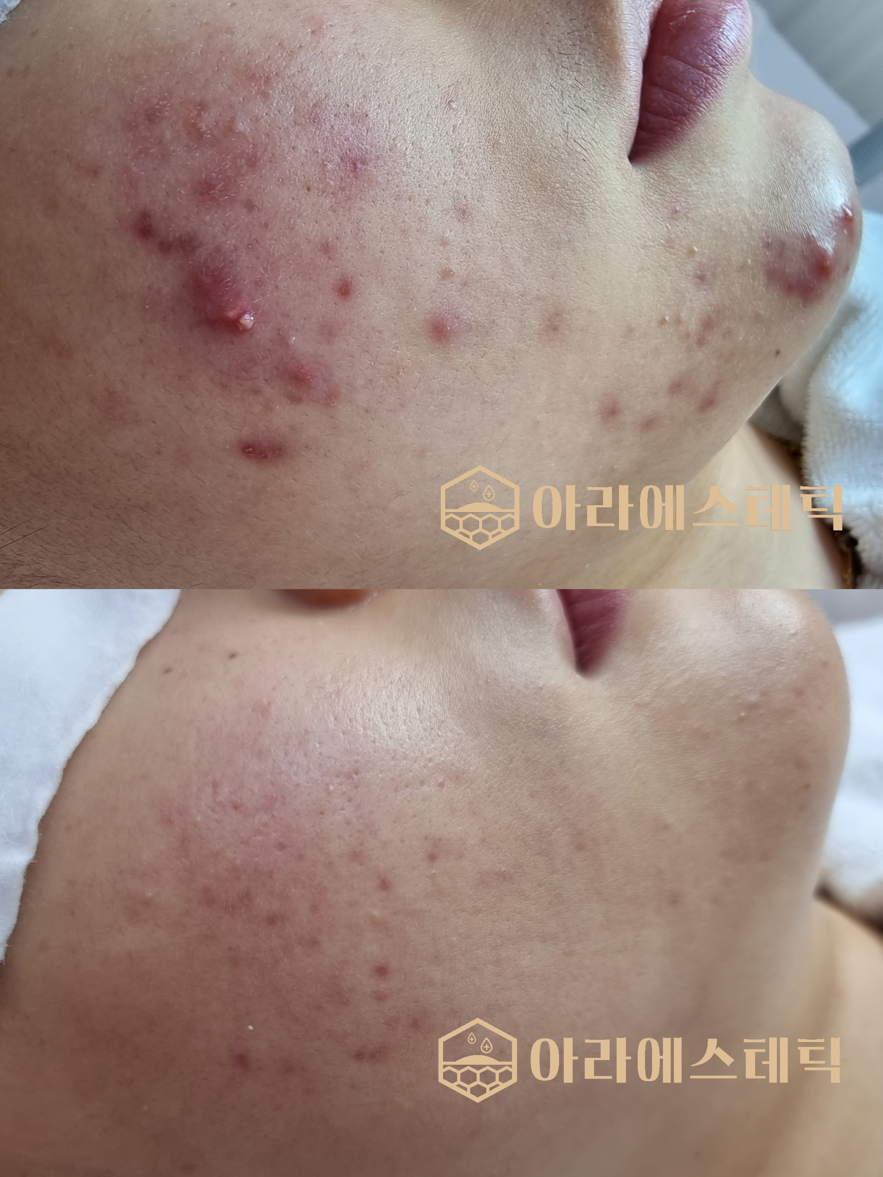 아라에스테틱 광주점 대표 이미지