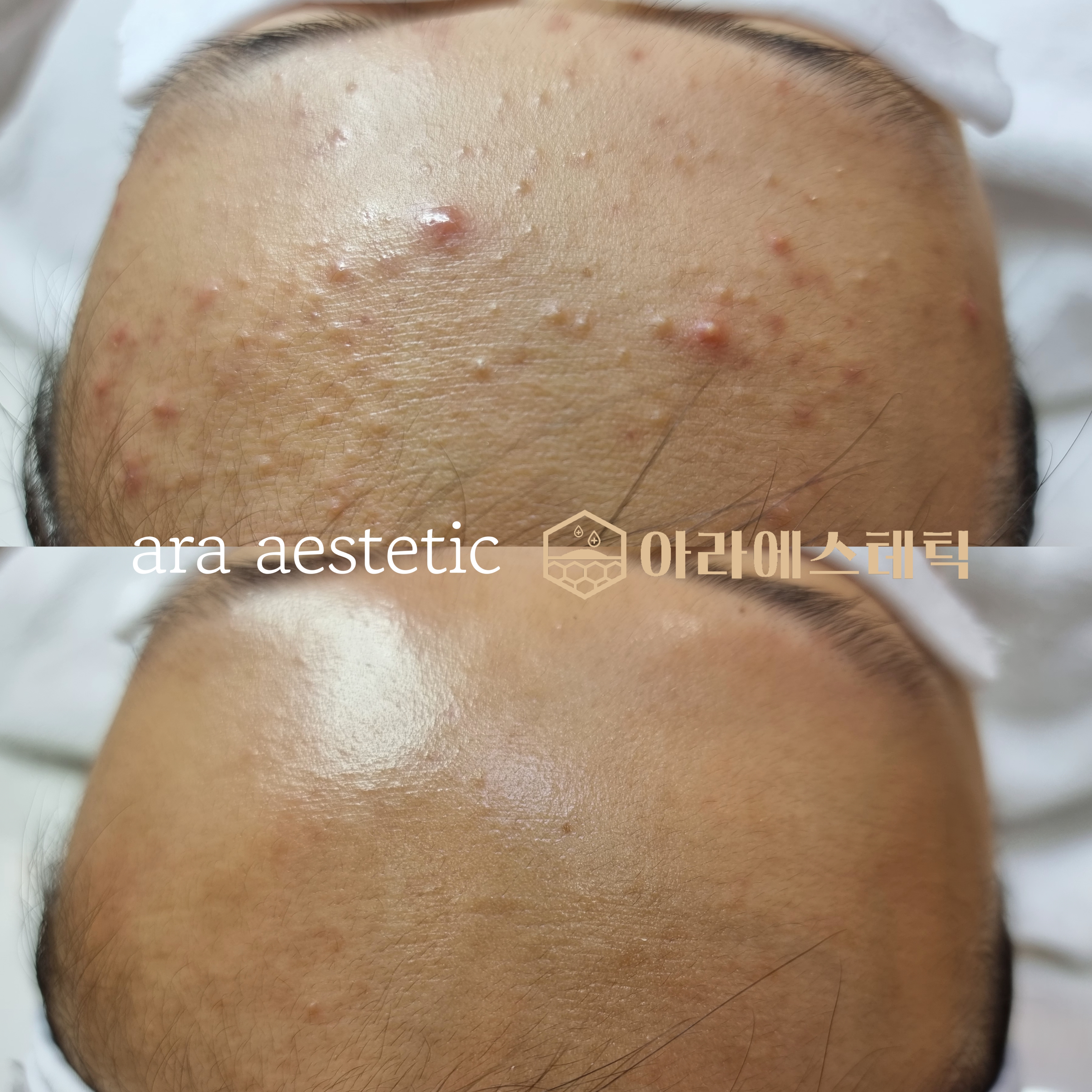 아라에스테틱 광주점 대표 이미지