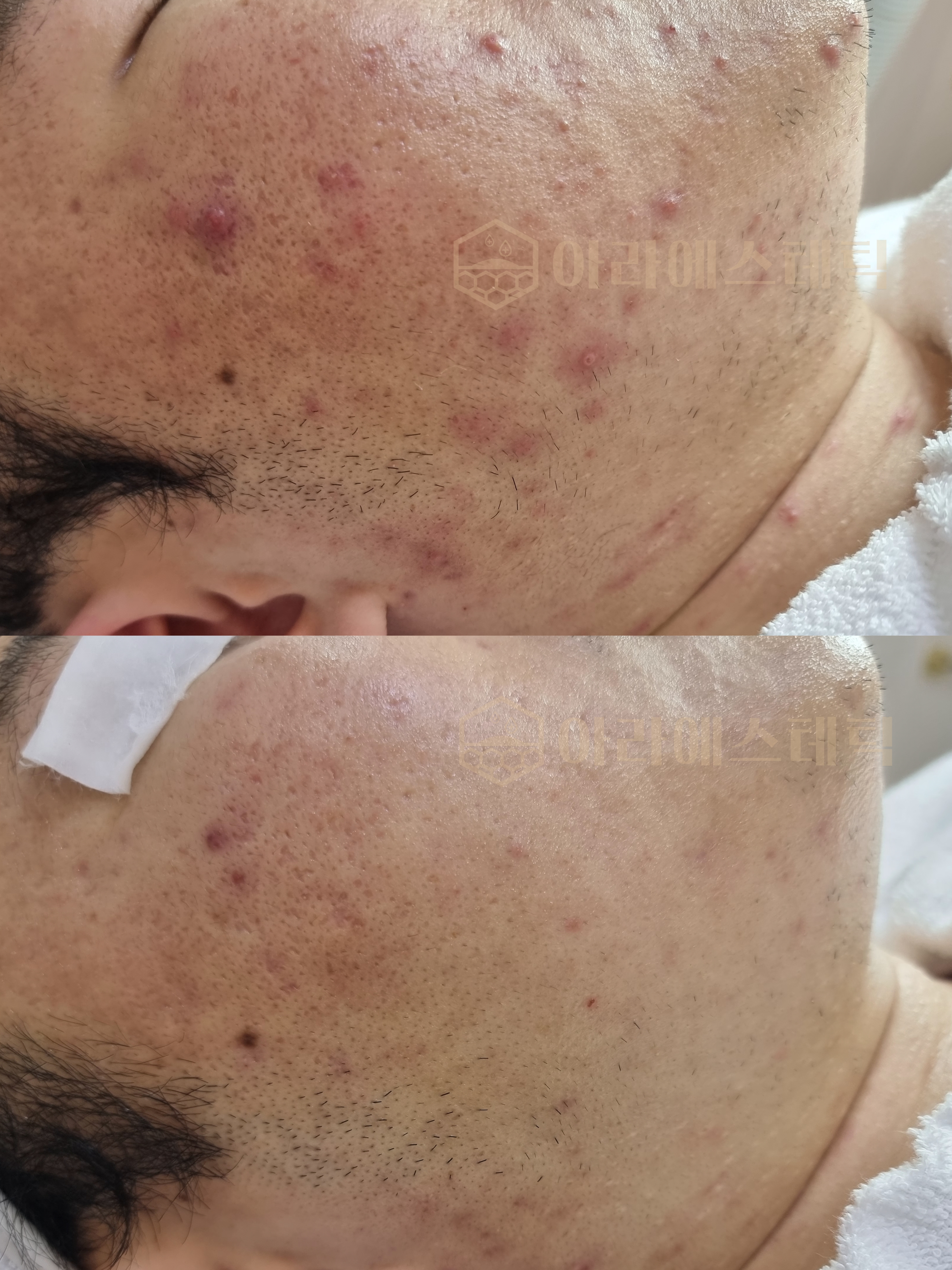 아라에스테틱 광주점 대표 이미지