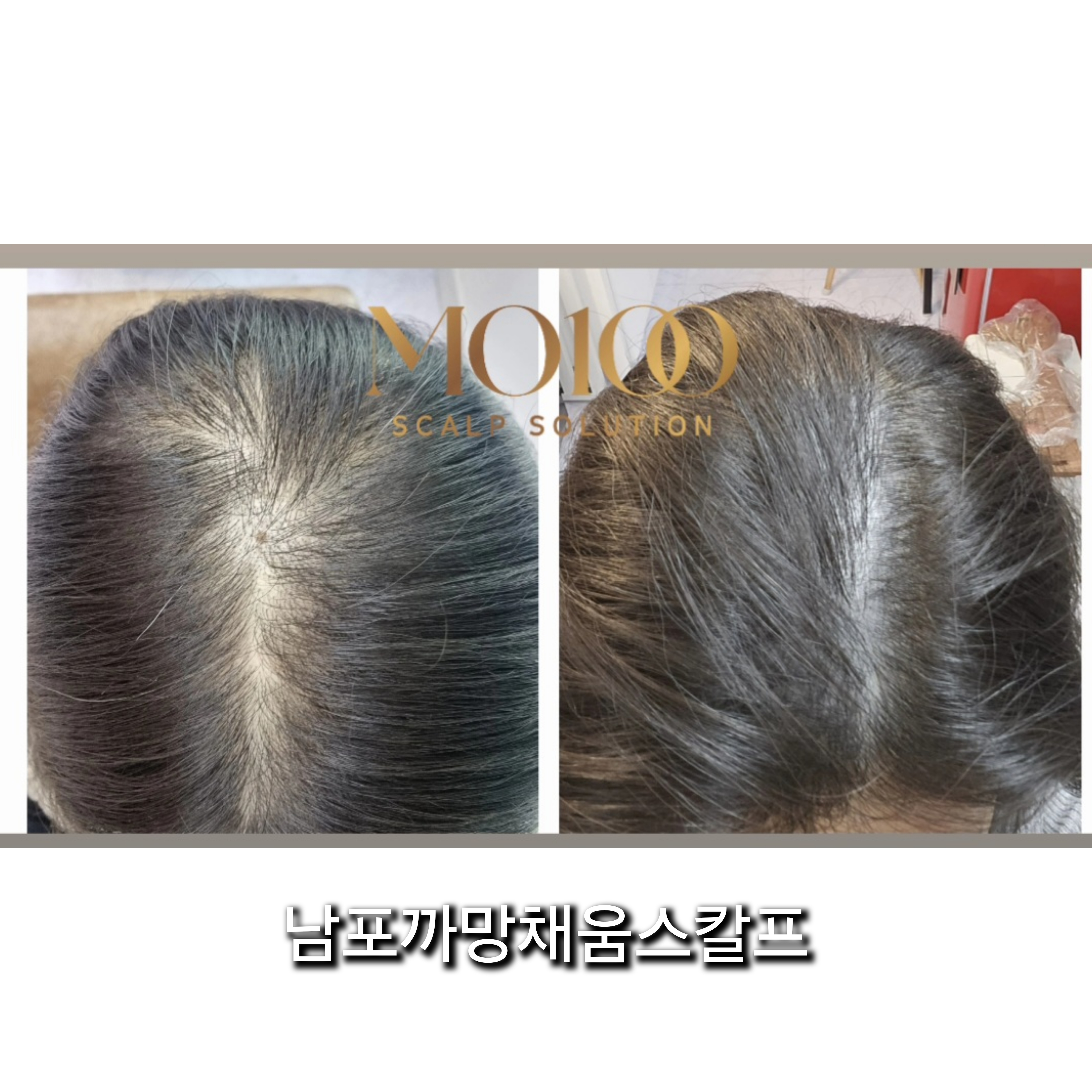 까망채움스칼프