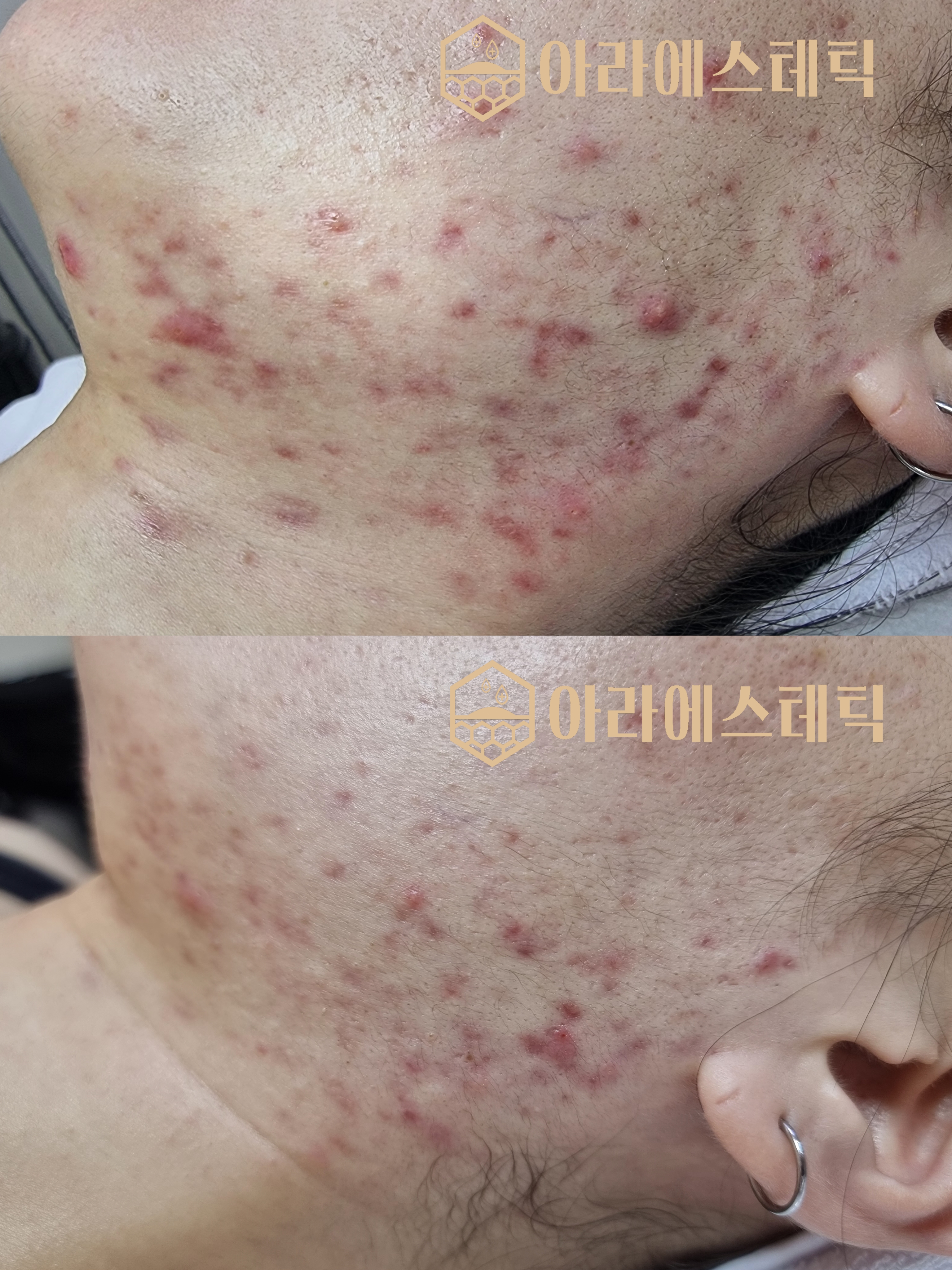 아라에스테틱 광주점 대표 이미지 - 관리실 내부