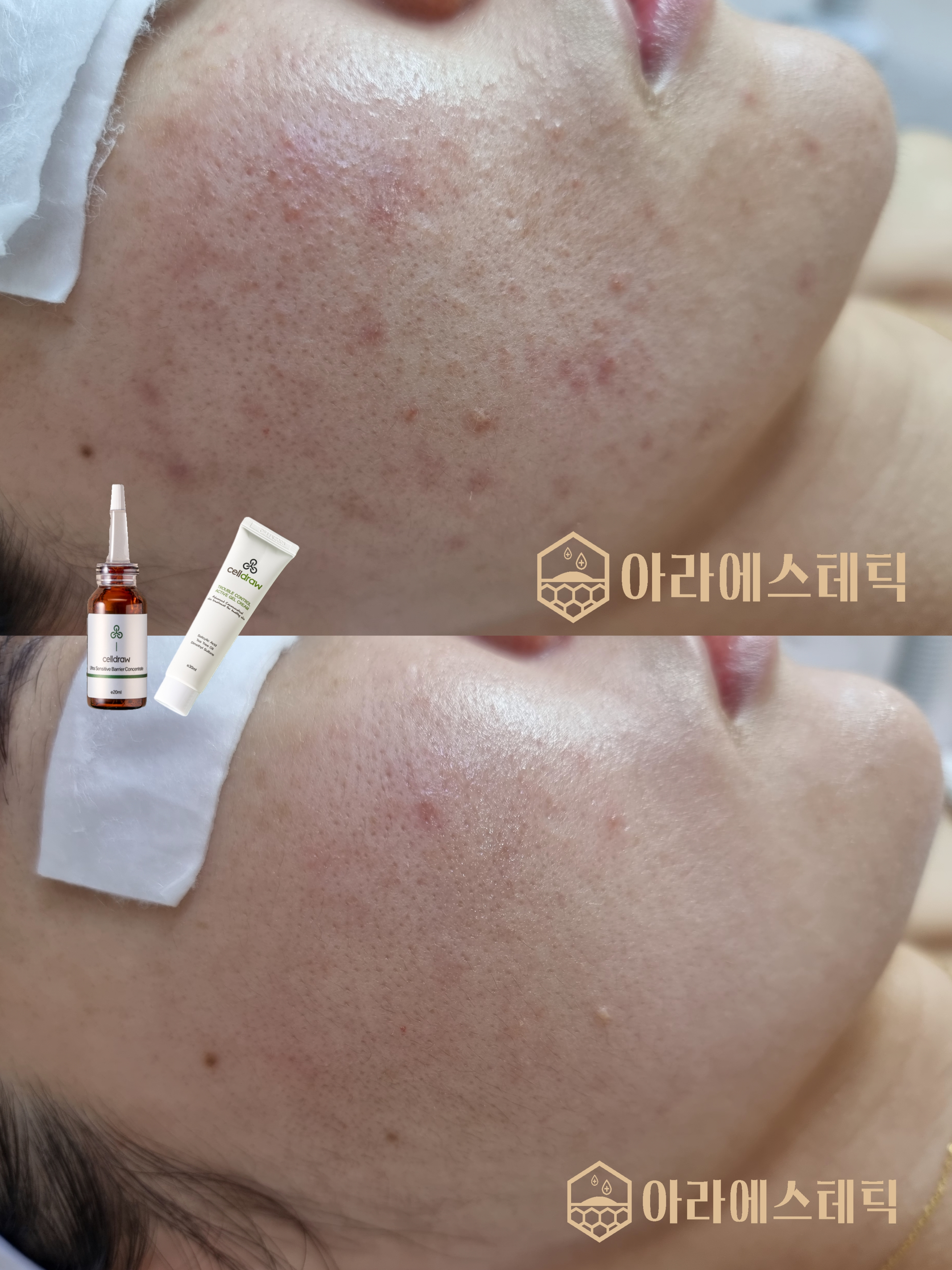 아라에스테틱 광주점 대표 이미지