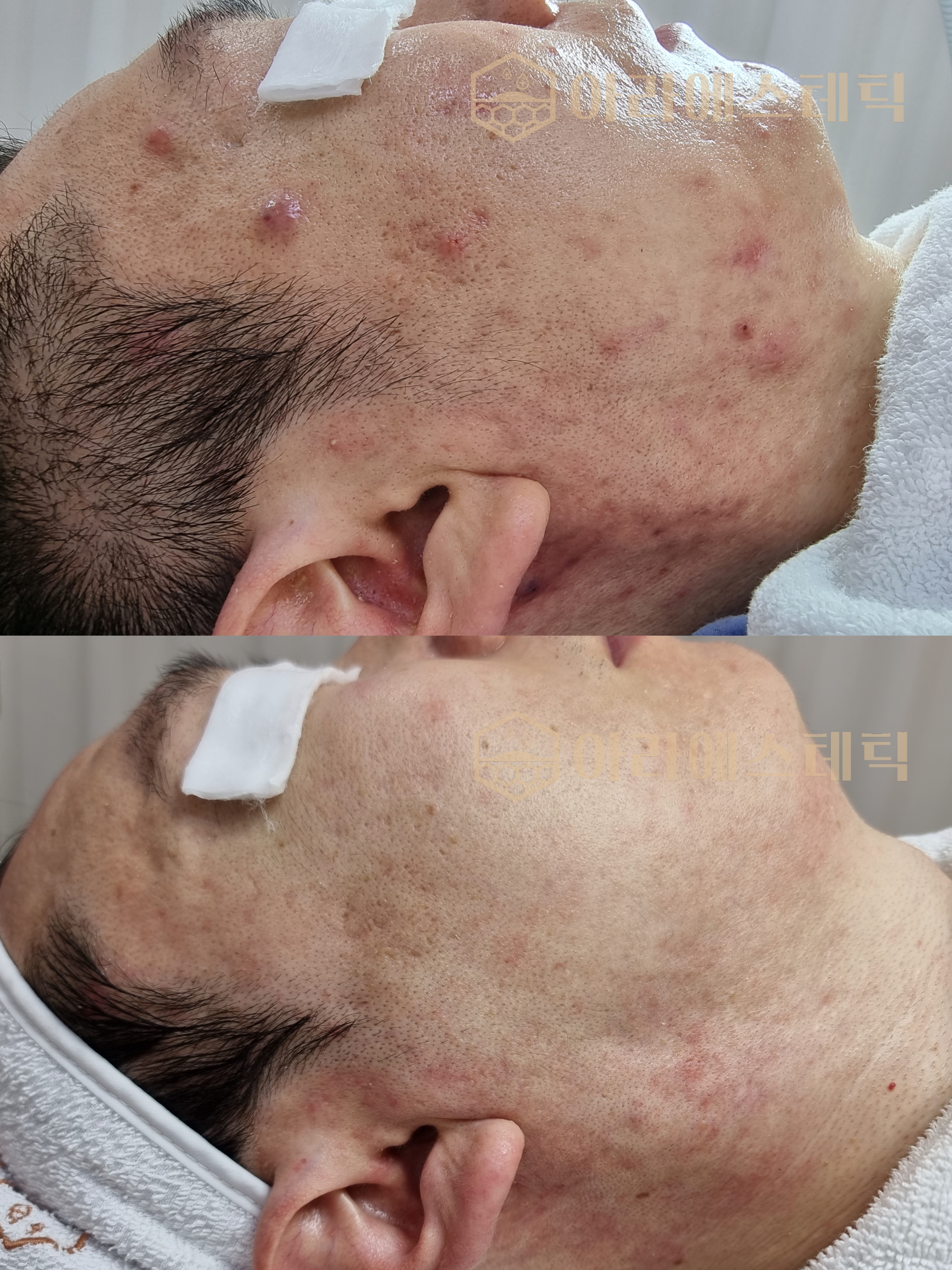 아라에스테틱 광주점 대표 이미지
