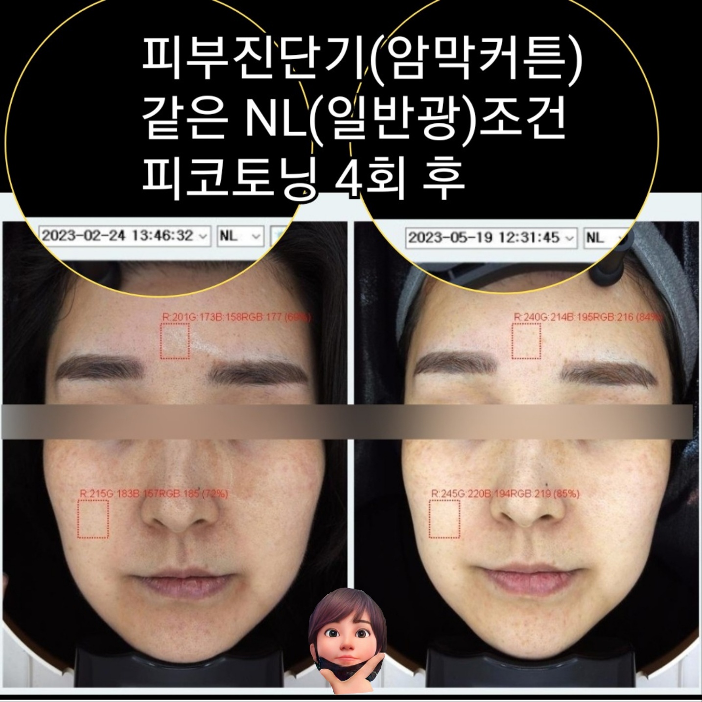 셀포랩 라라뷰티