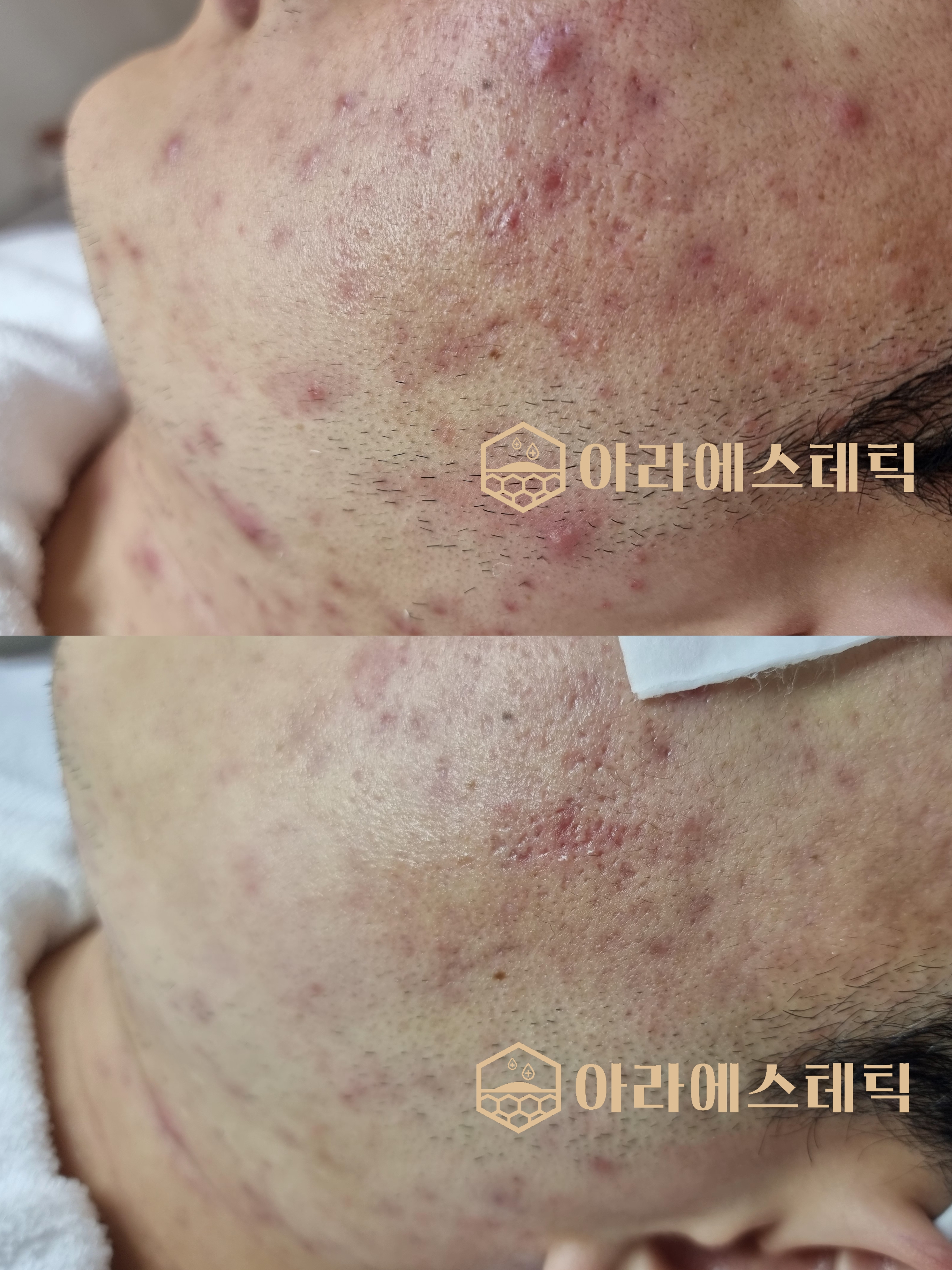 아라에스테틱 광주점