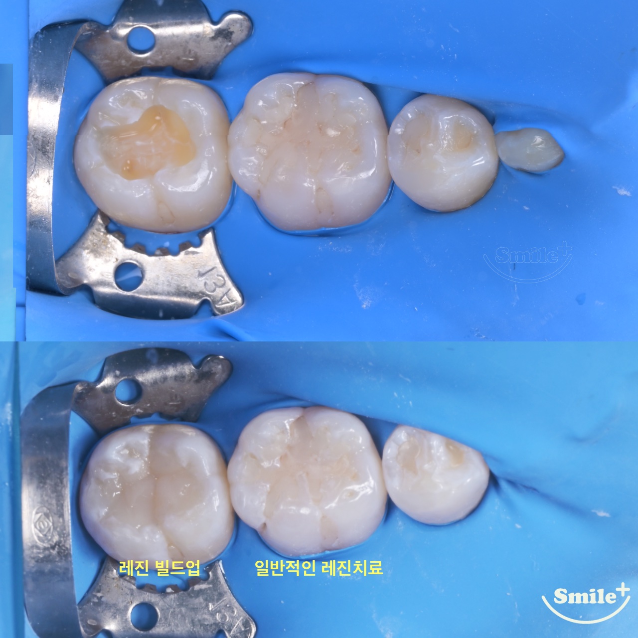 스마일플러스 치과의원 대표 이미지
