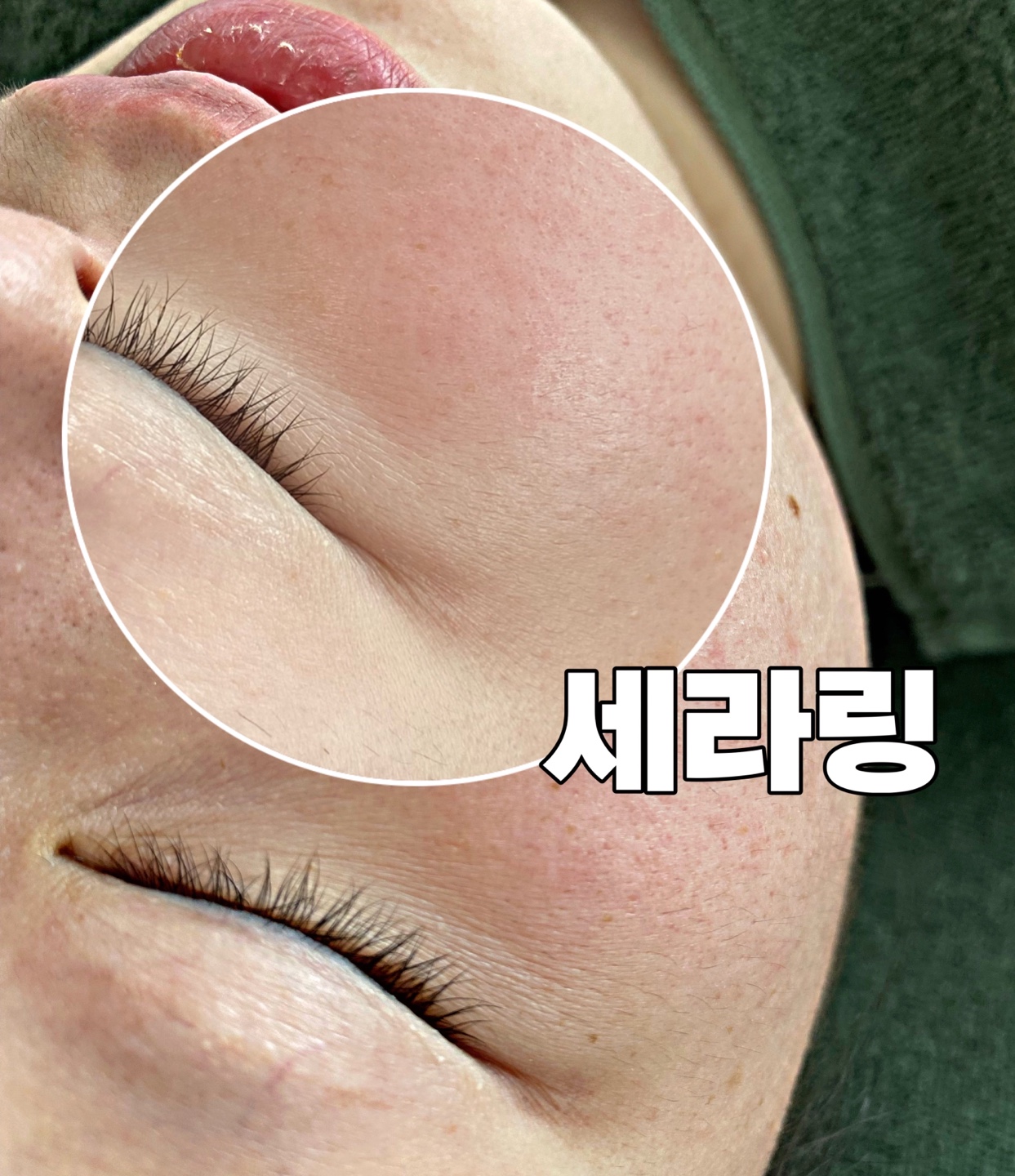 매료한 슈가링왁싱&스킨 명지점