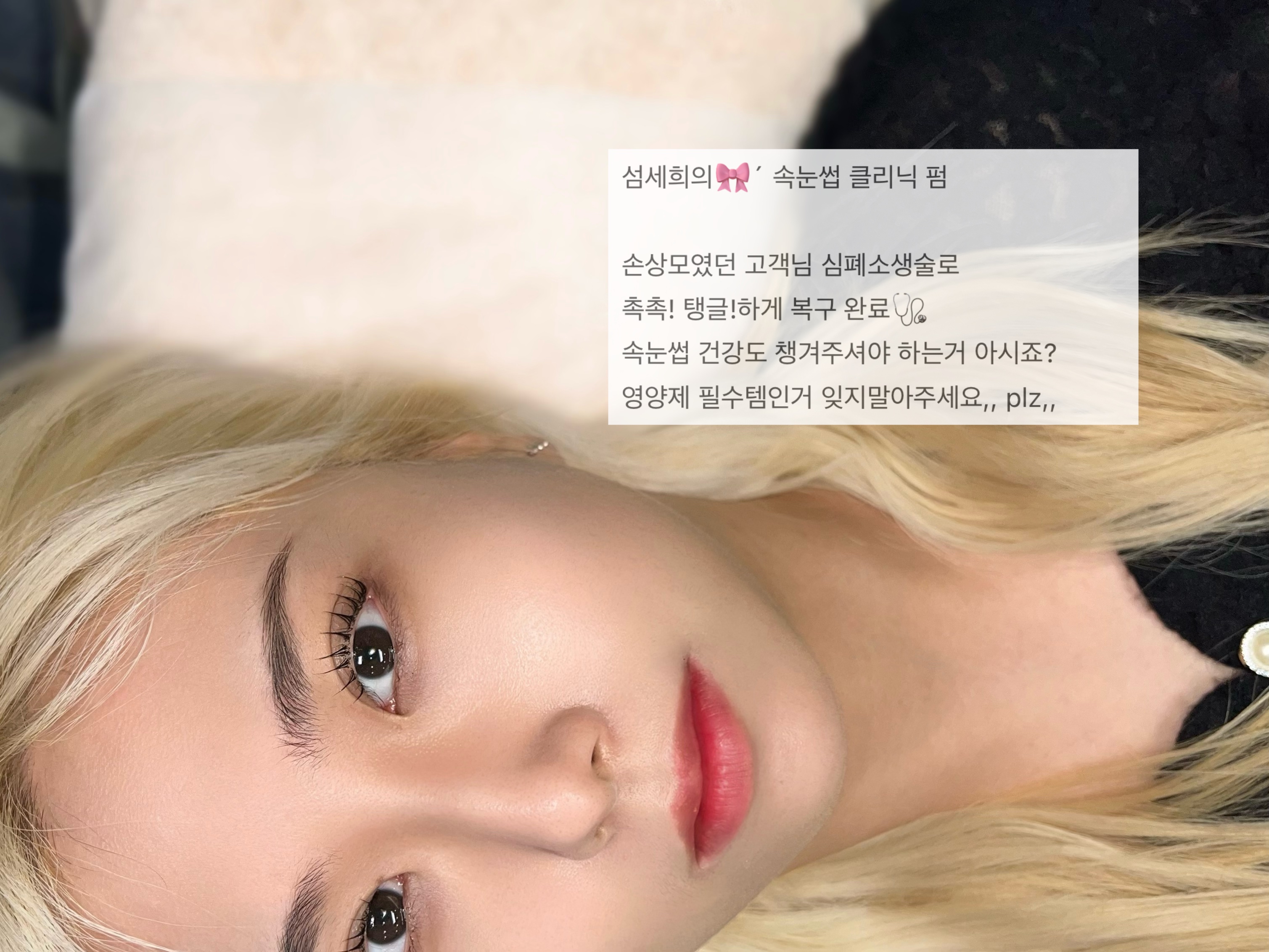 섬세희